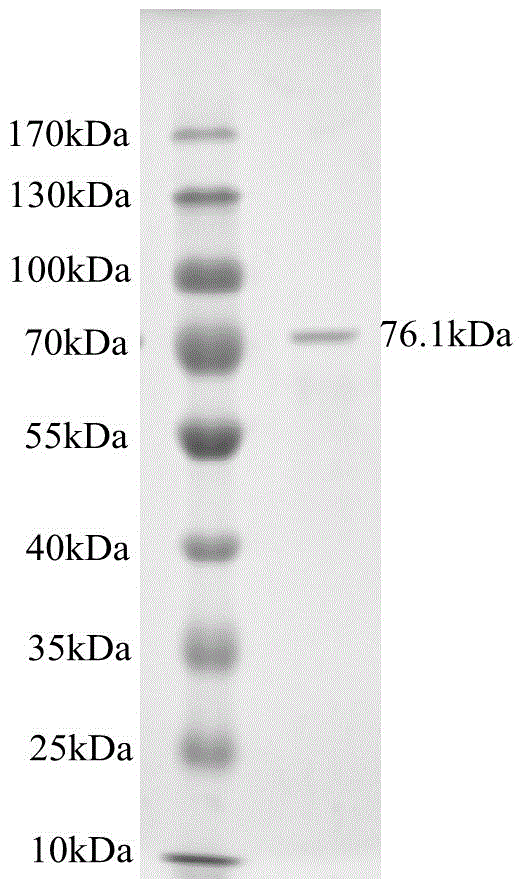Bacterium and chondrosulphatase ABC generated by same