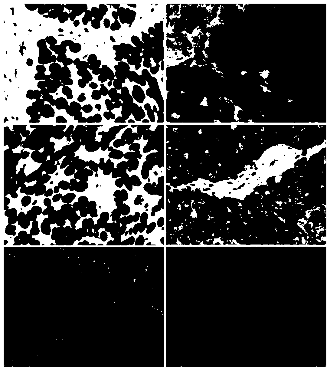 Immunohistochemical double-molecular-target single staining kit as well as using method and application thereof
