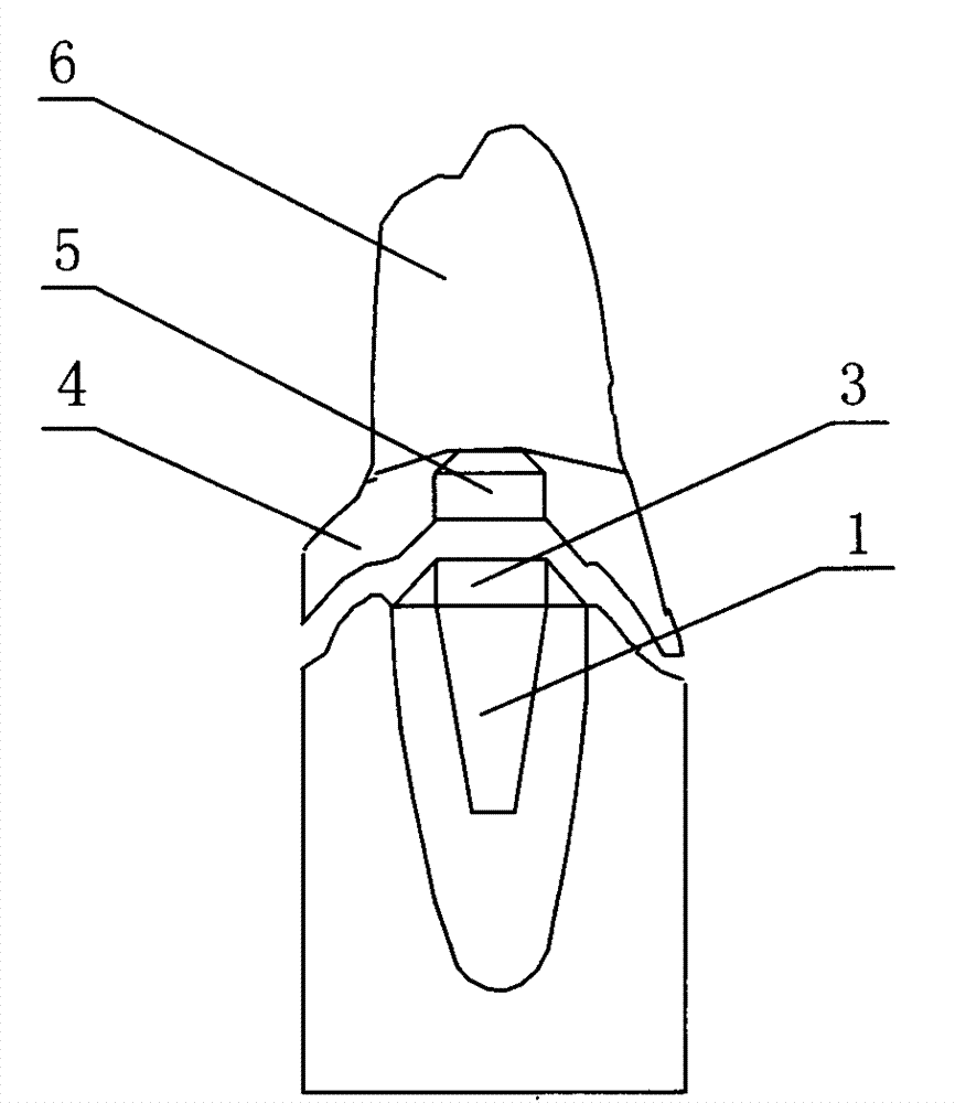 Magnetic retaining device for false tooth connecting rod