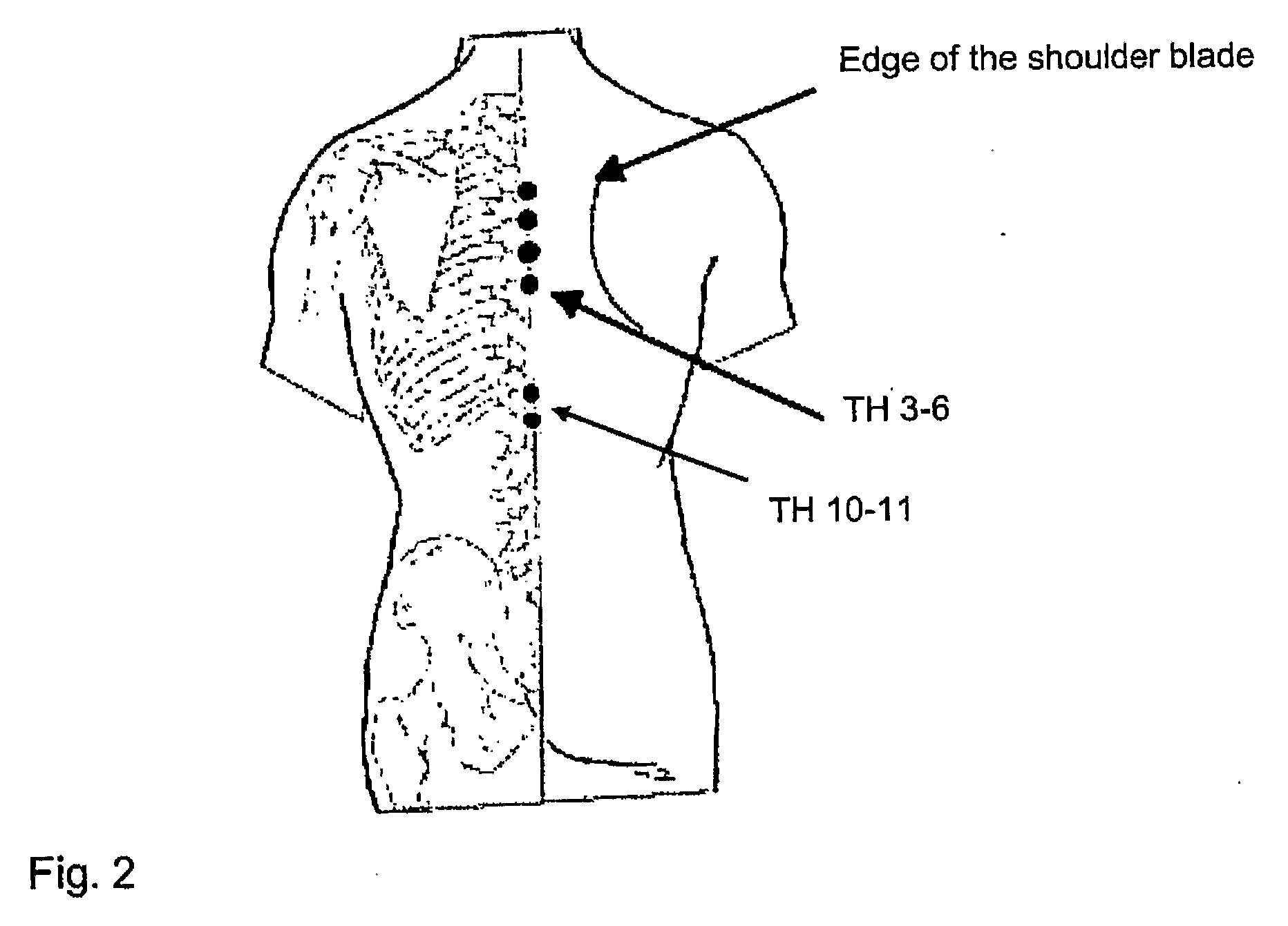 Method of determining the sympathetic tone and system for measurement thereof