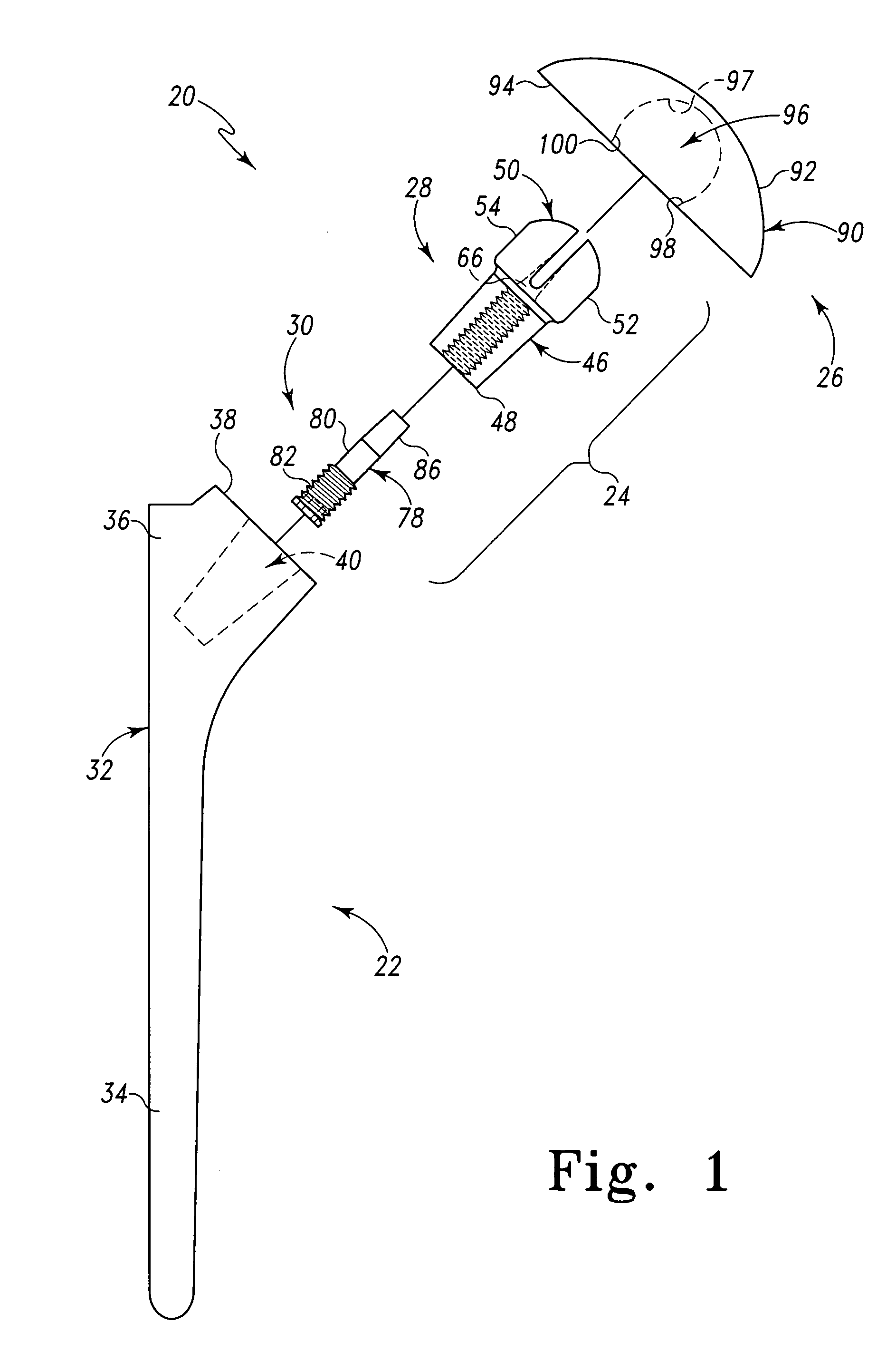 Shoulder prosthesis having infinitely adjustable humeral head