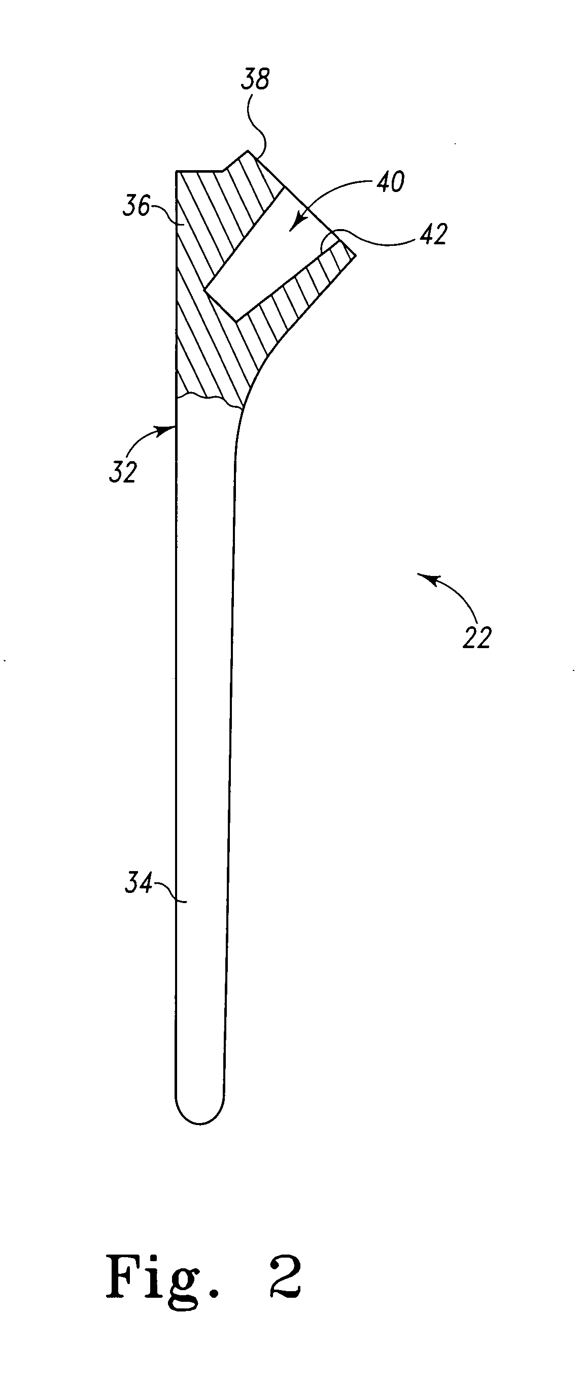 Shoulder prosthesis having infinitely adjustable humeral head