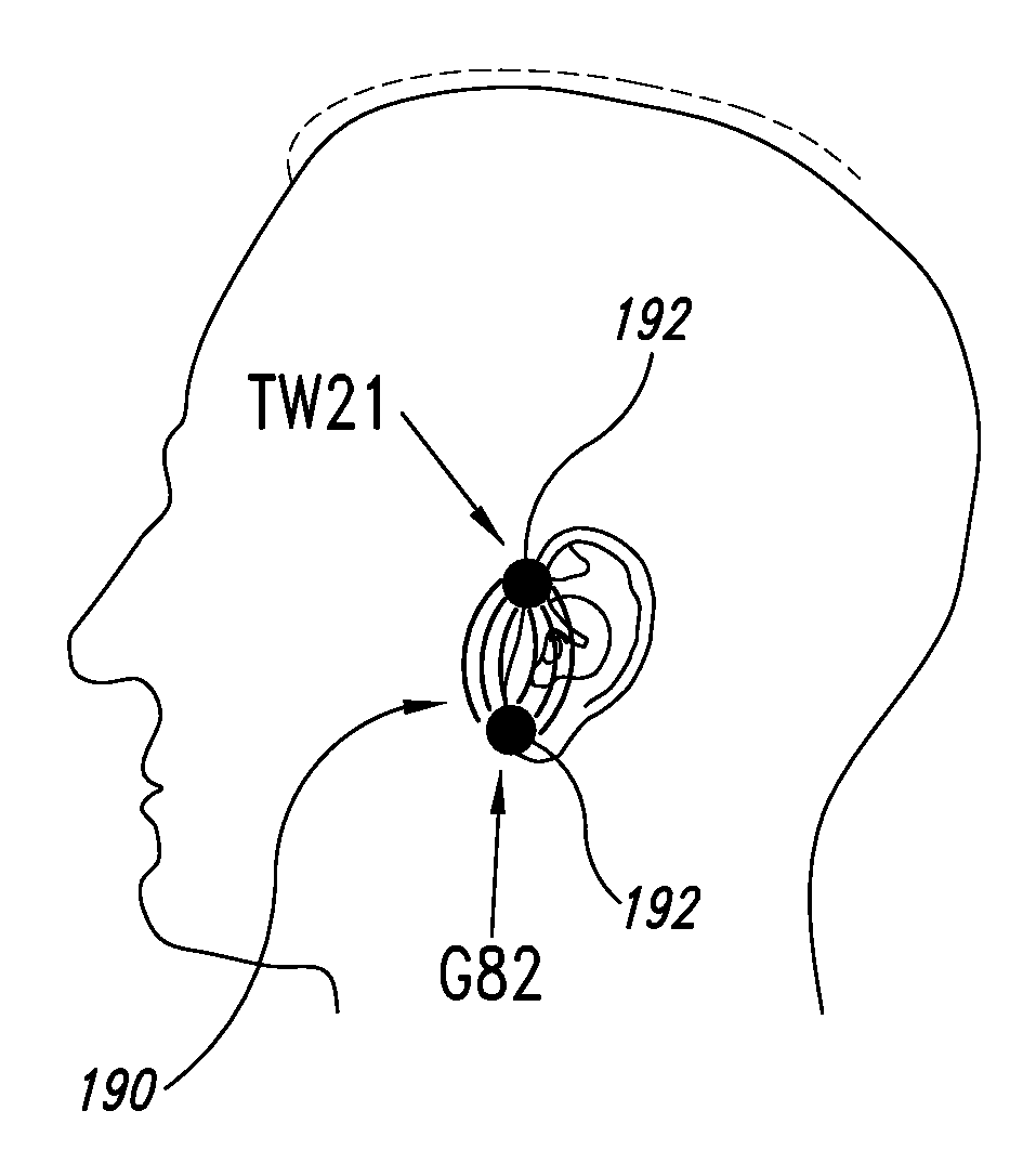 Systems, apparatuses, and methods for providing non-transcranial electrotherapy