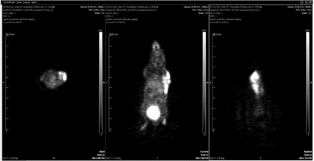 [&lt;18&gt;F] AlF marked positron emission tomography (PET) polypeptide probe and preparation method thereof