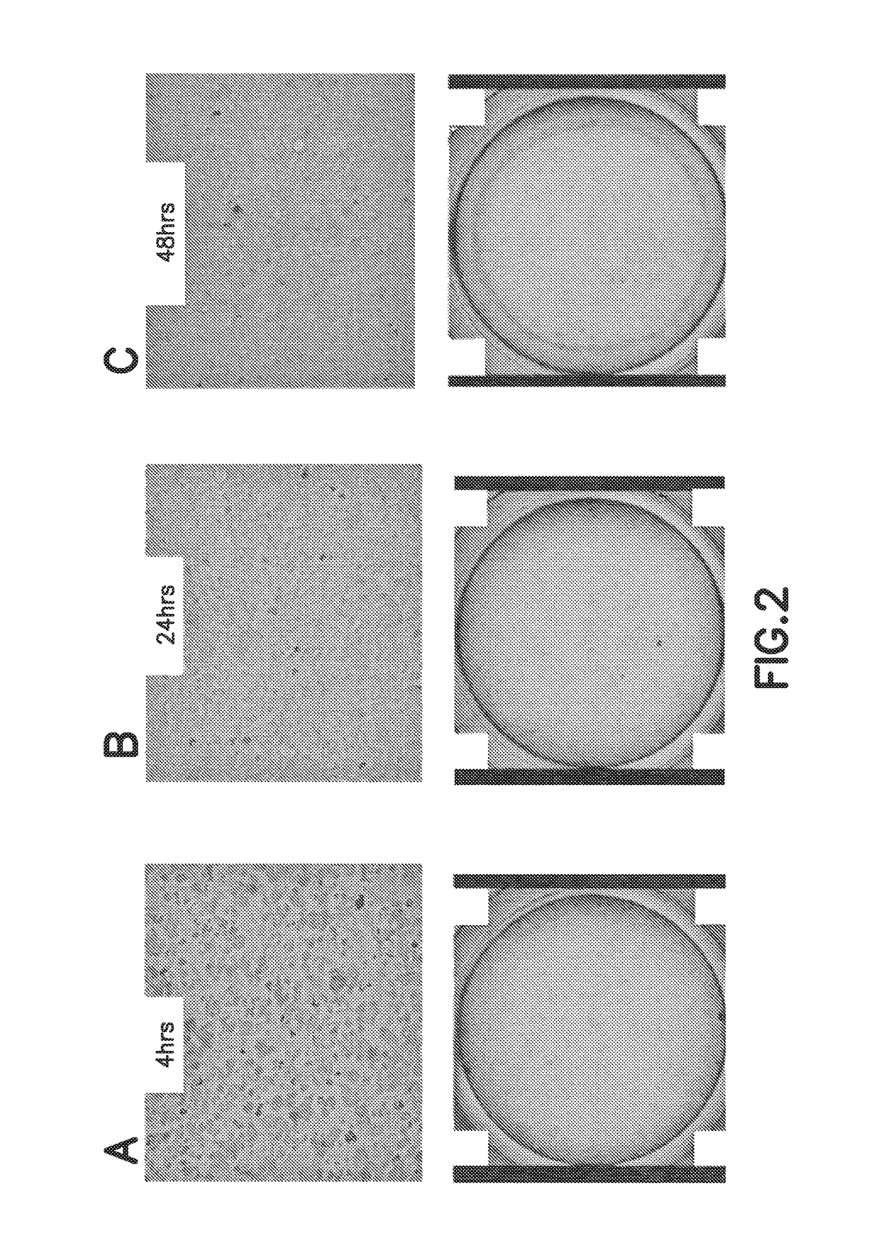 Consumable cryopreserved cells transiently overexpressing gene(s) encoding drug transporter protein(s)