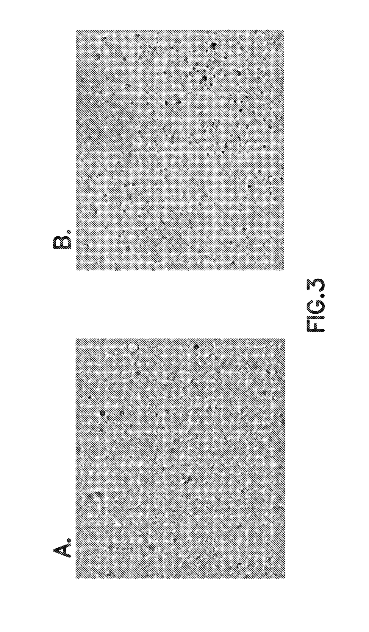 Consumable cryopreserved cells transiently overexpressing gene(s) encoding drug transporter protein(s)