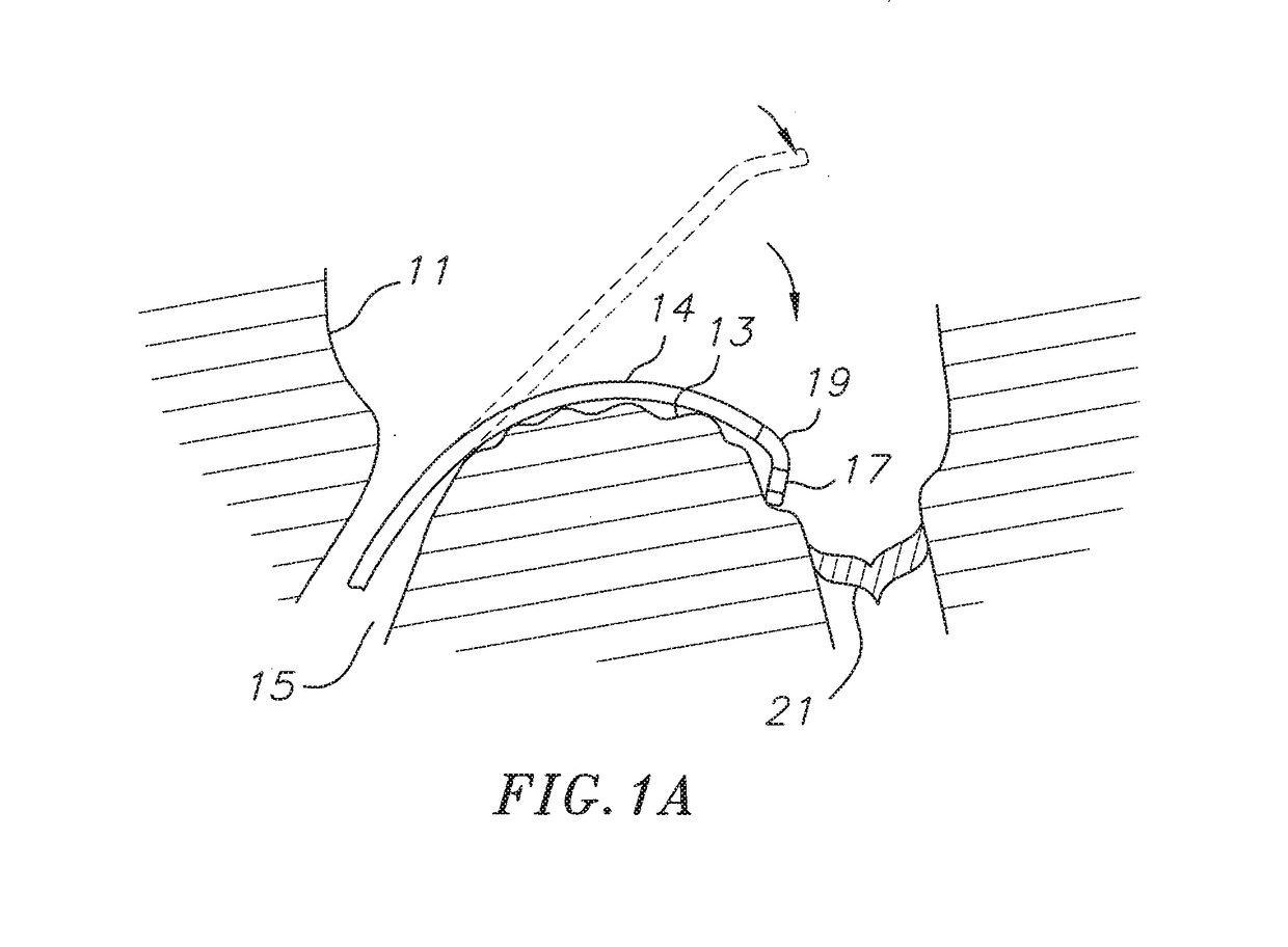 Deflectable catheter with a flexibly attached tip section