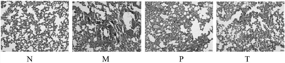 Applications of pseudolaric acid B in preparation of anti-pulmonary-fibrosis medicines