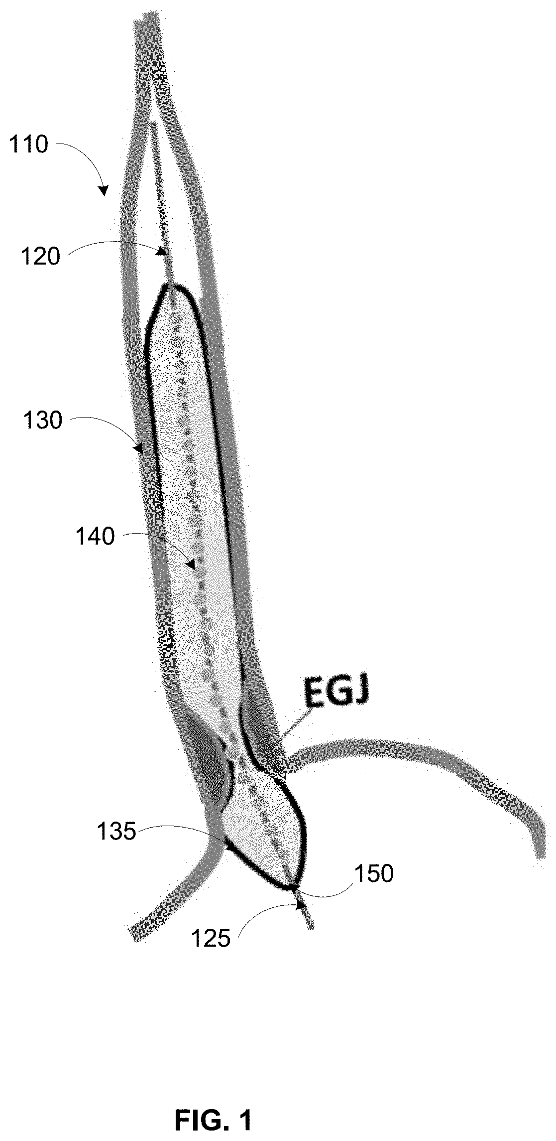 Systems, methods, and apparatus for esophageal panometry