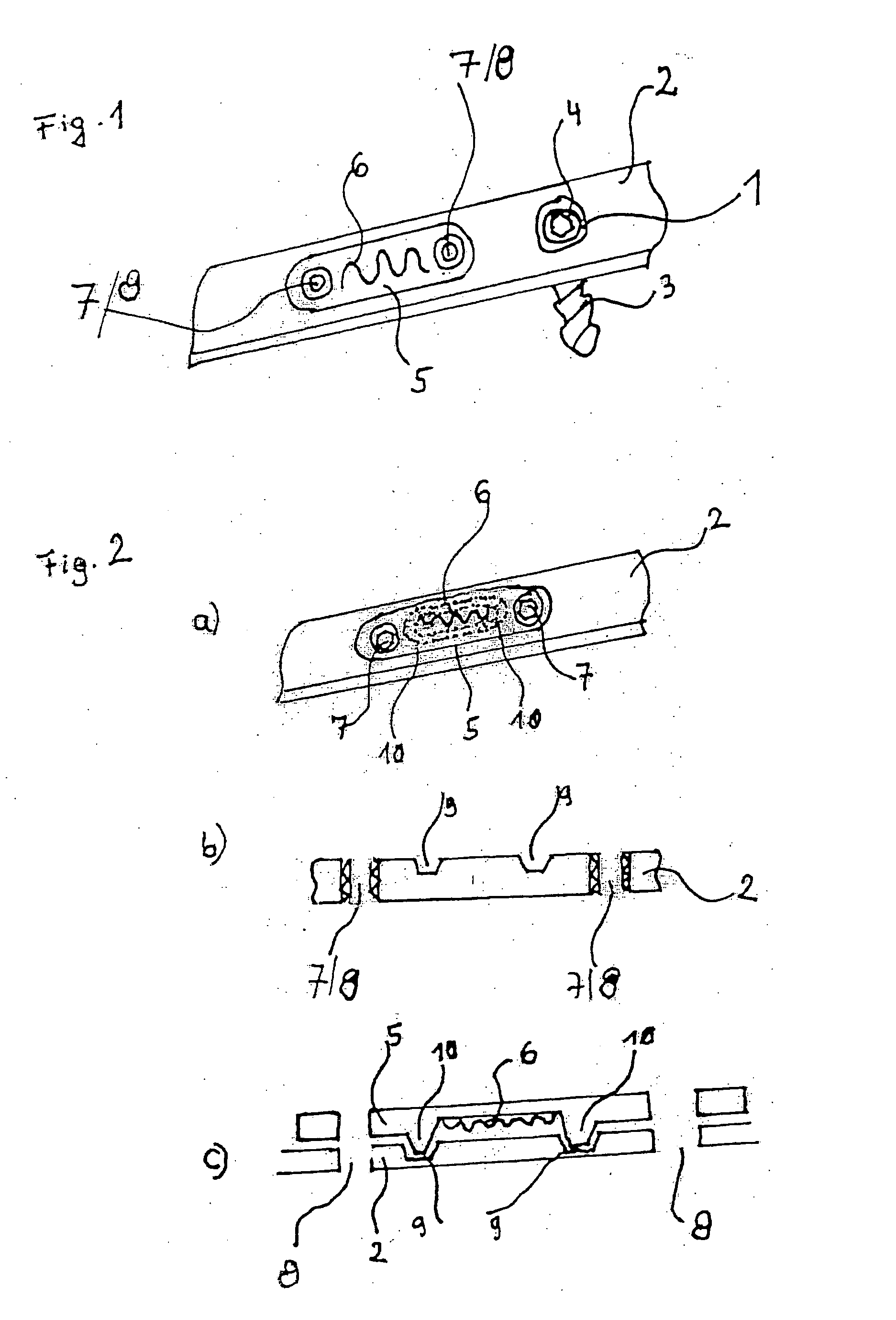 Fixation system for bones with a sensor and telemetry system