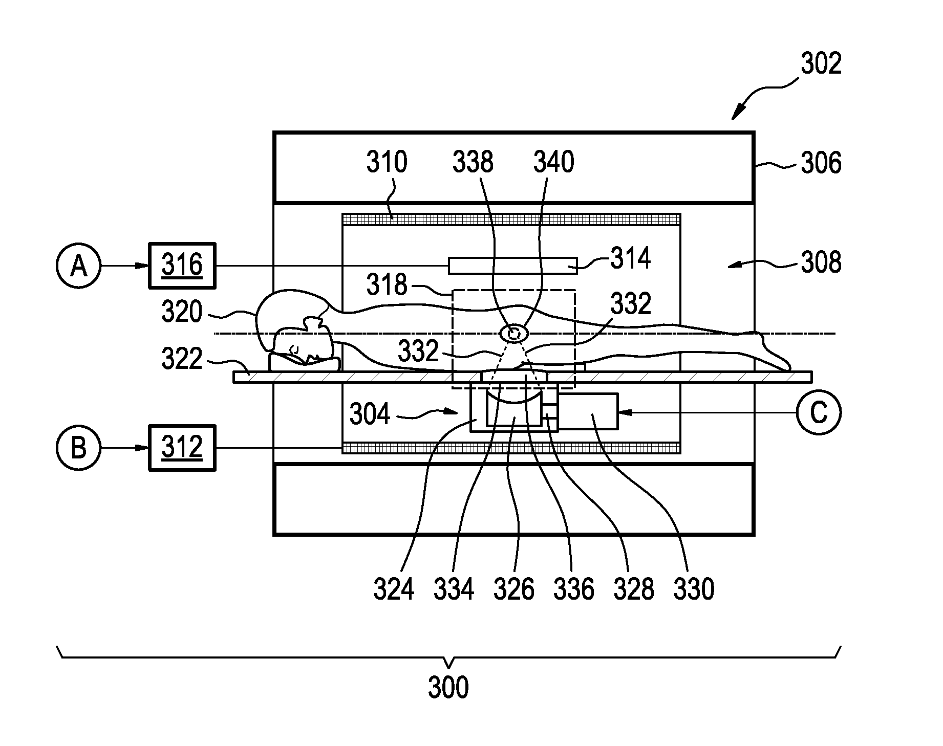 Medical apparatus for radiotherapy and ultrasound heating