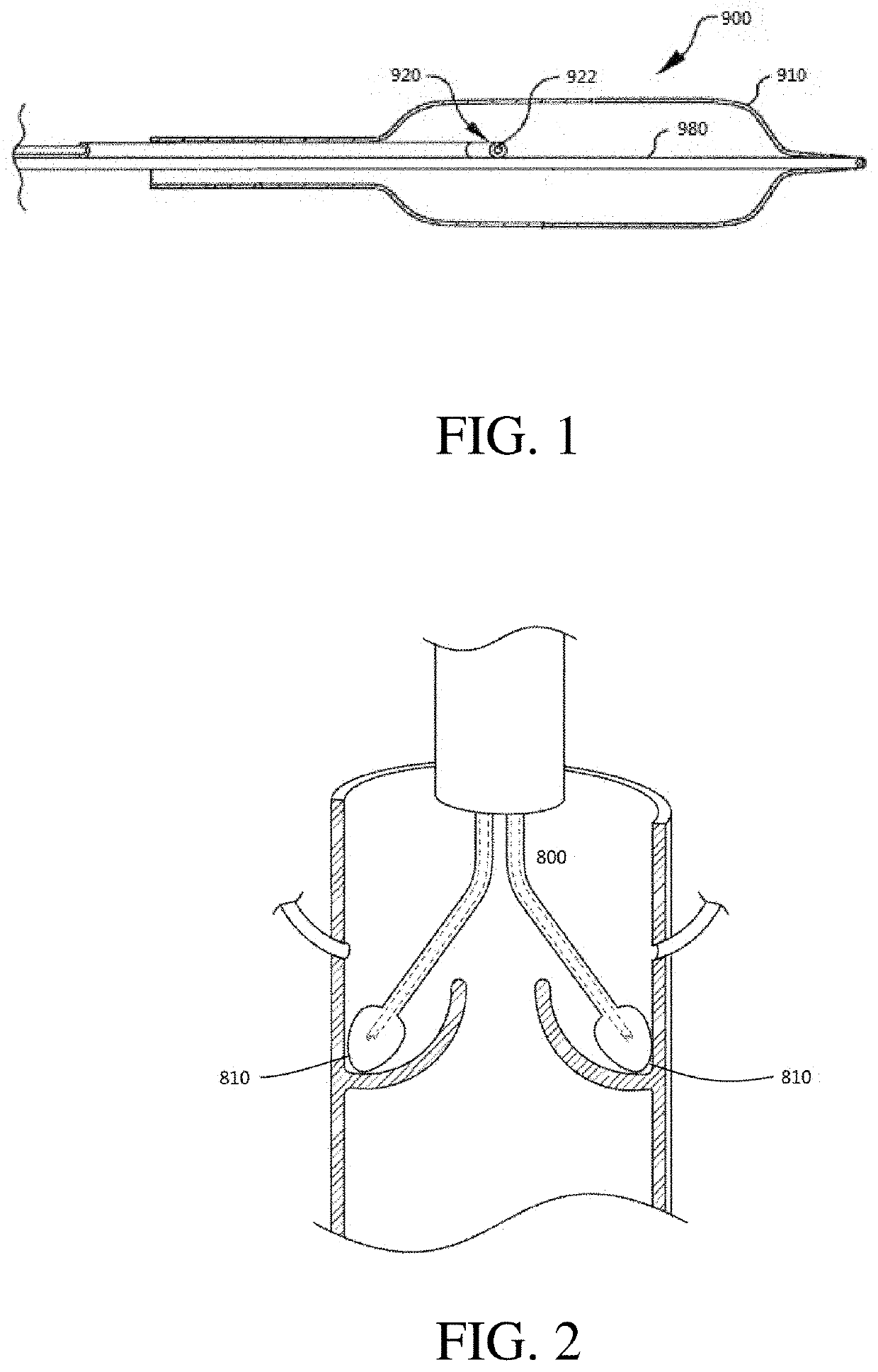 Device and method for treating heart valve or vascular calcification