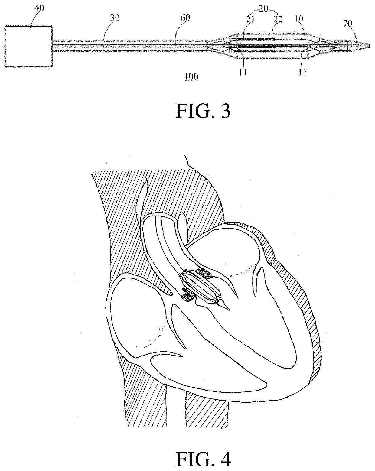 Device and method for treating heart valve or vascular calcification