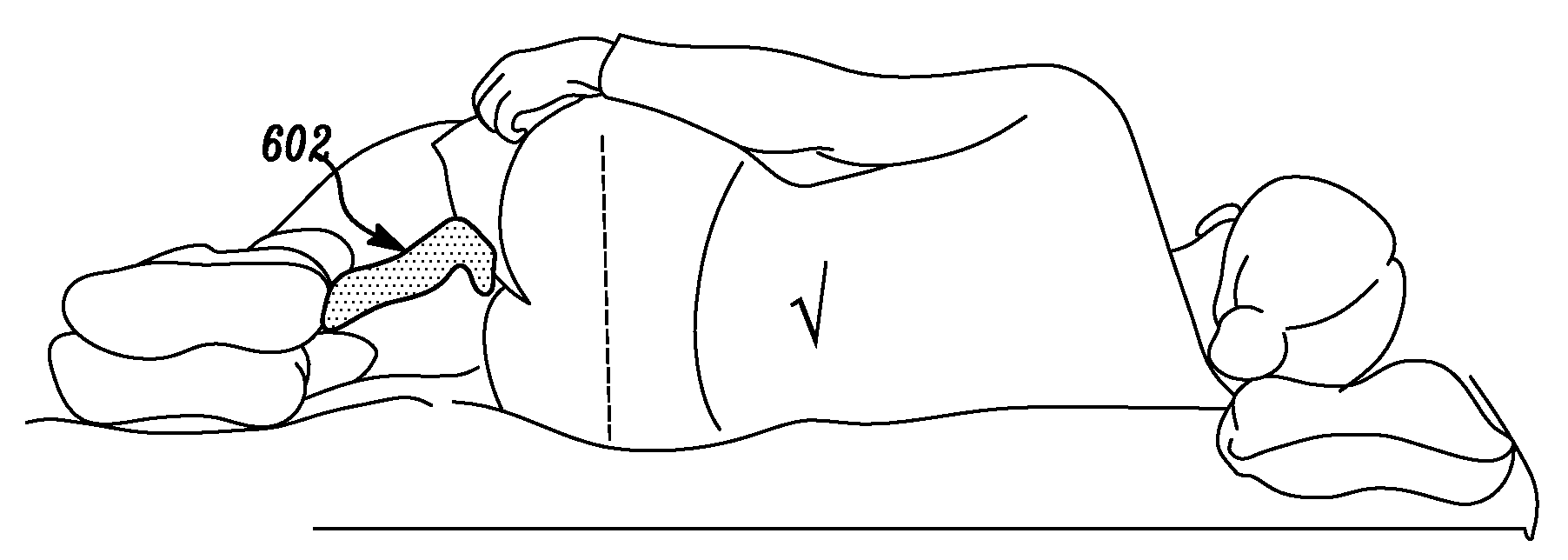 Body-positioning aid for body alignment