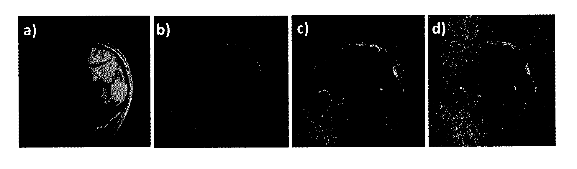 Method for accelerating magnetic resonance imaging using varying k-space sampling density and phase-constrained reconstruction