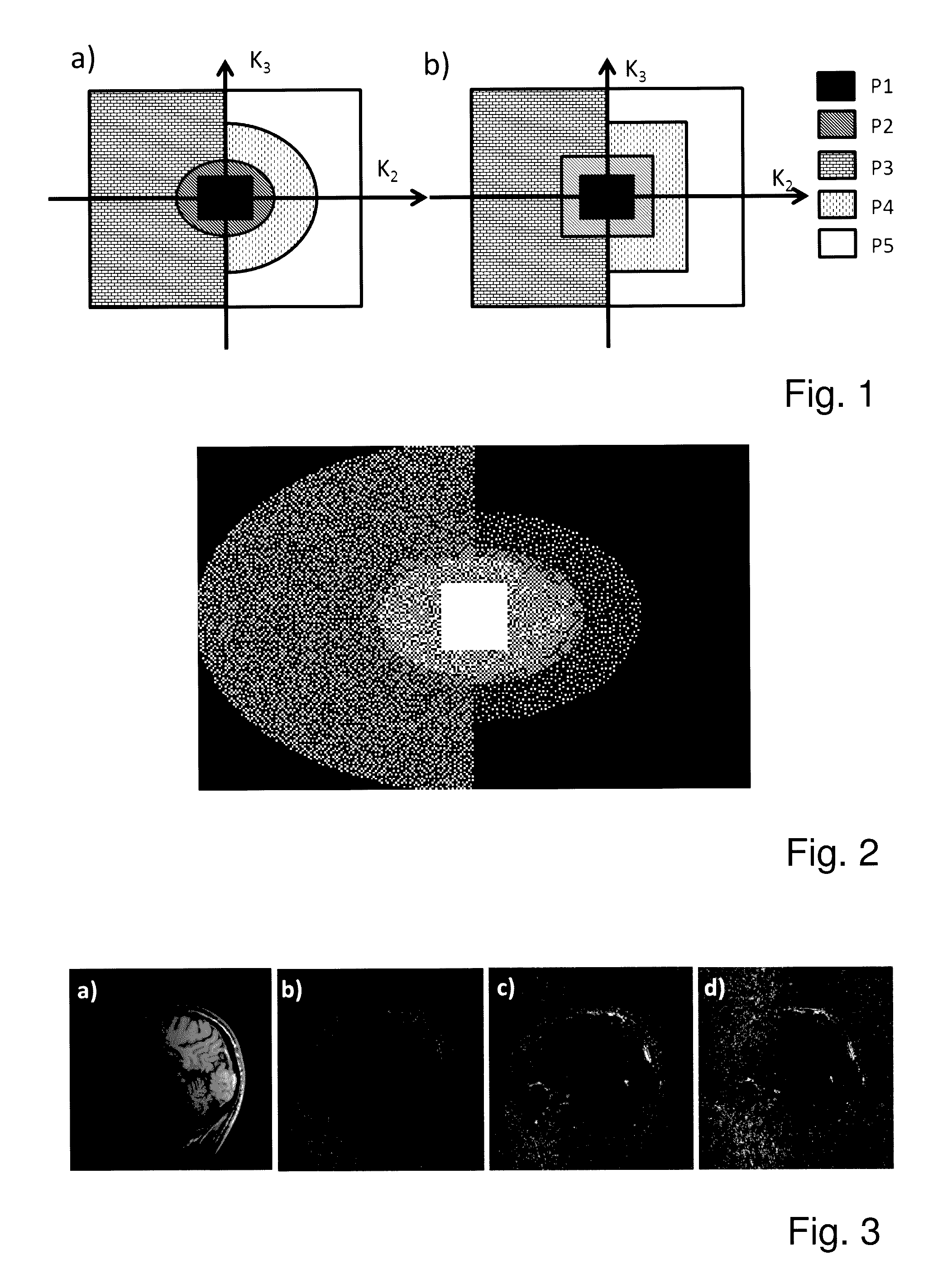 Method for accelerating magnetic resonance imaging using varying k-space sampling density and phase-constrained reconstruction