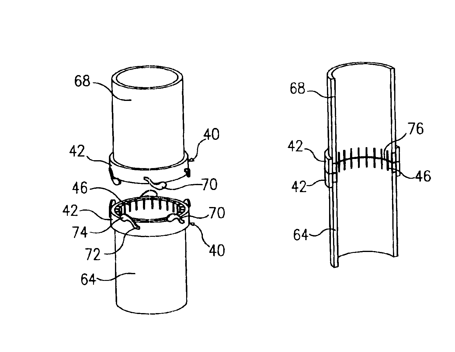 Connectors for hollow anatomical structures and methods of use