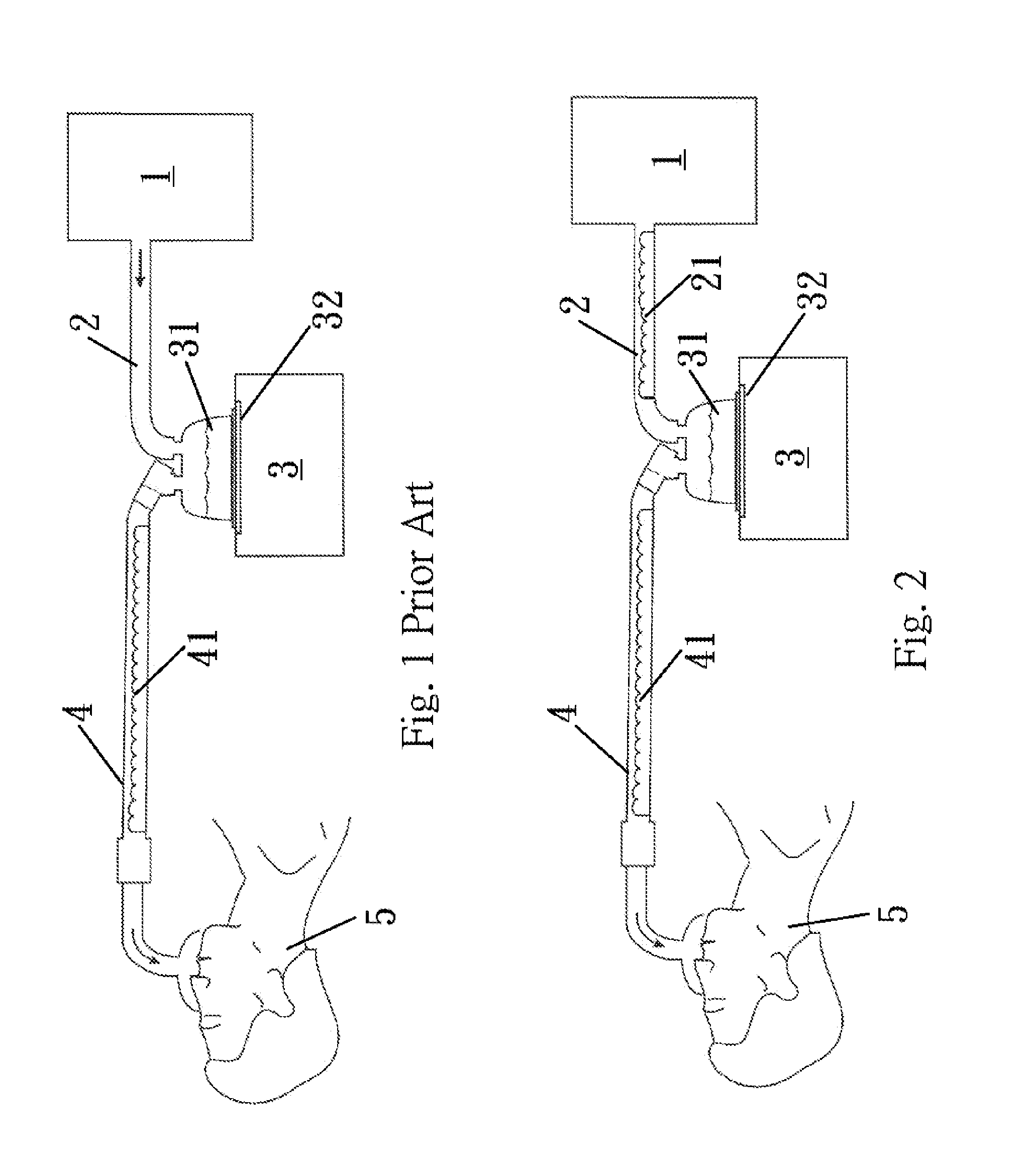 Preheating device of the pipeline between air pressure source and humidifier
