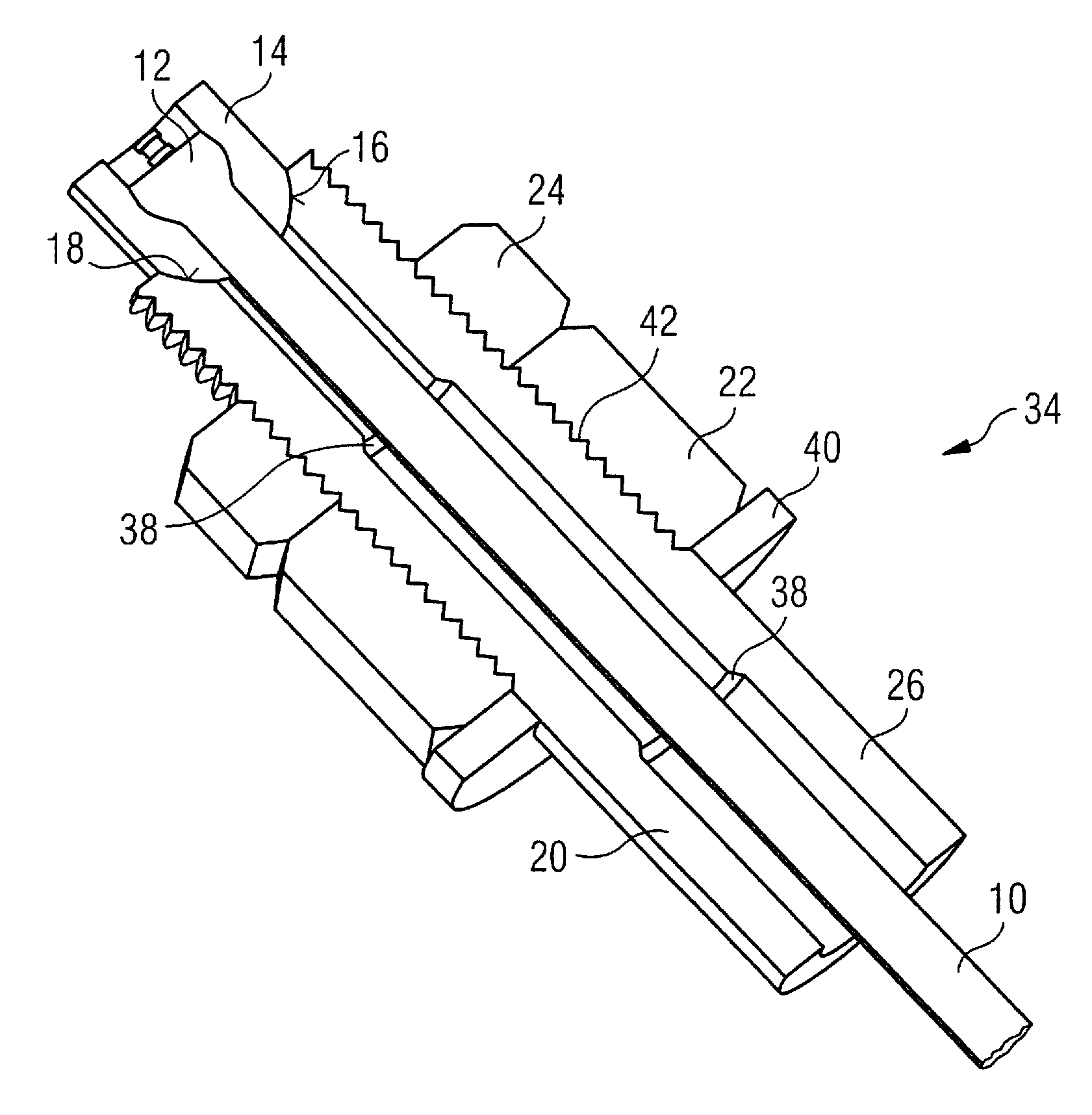 Suspension rod tensioning arrangements for supporting cryogenic equipment within a cryostat