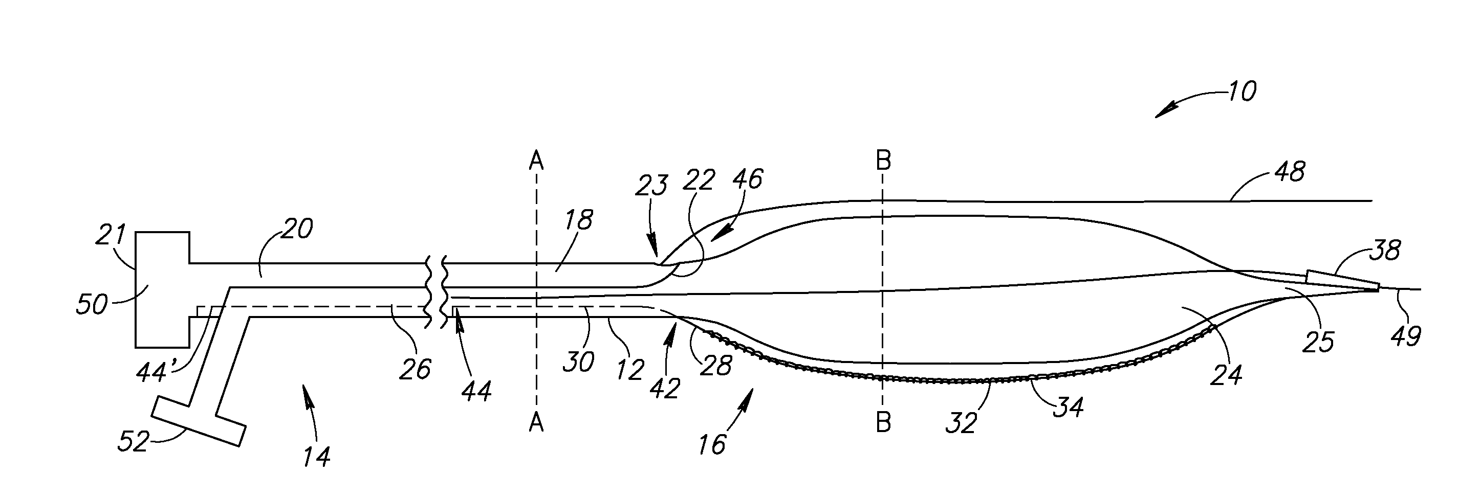 Systems and methods for treating a vessel using focused force