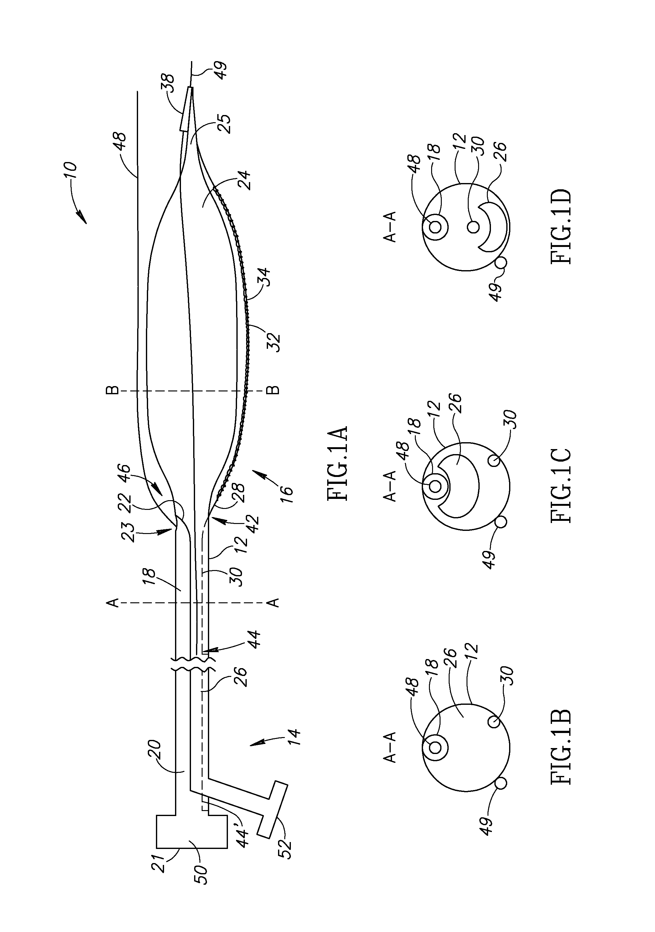 Systems and methods for treating a vessel using focused force