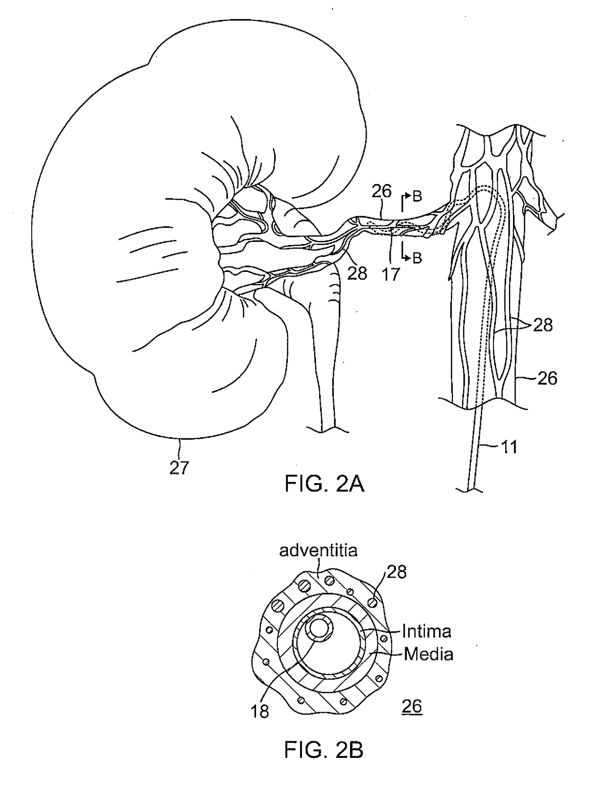 System and method for controlling catheter power based on renal ablation response
