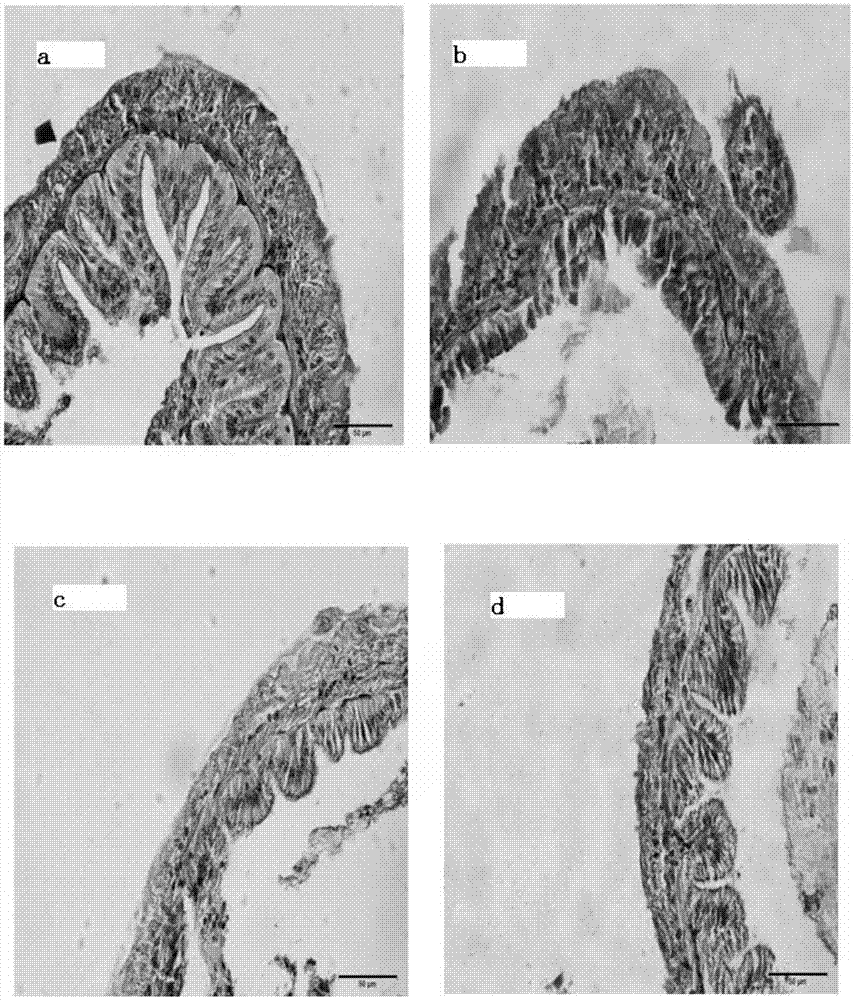 Composite additive for preventing prawn intestinal injury under condition of low-fish-meal and high-soybean-meal feed and preparation method of composite additive