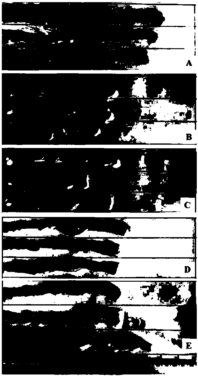 Lindera aggregata compound with antagonistic effect for inflammatory bowel diseases and application thereof