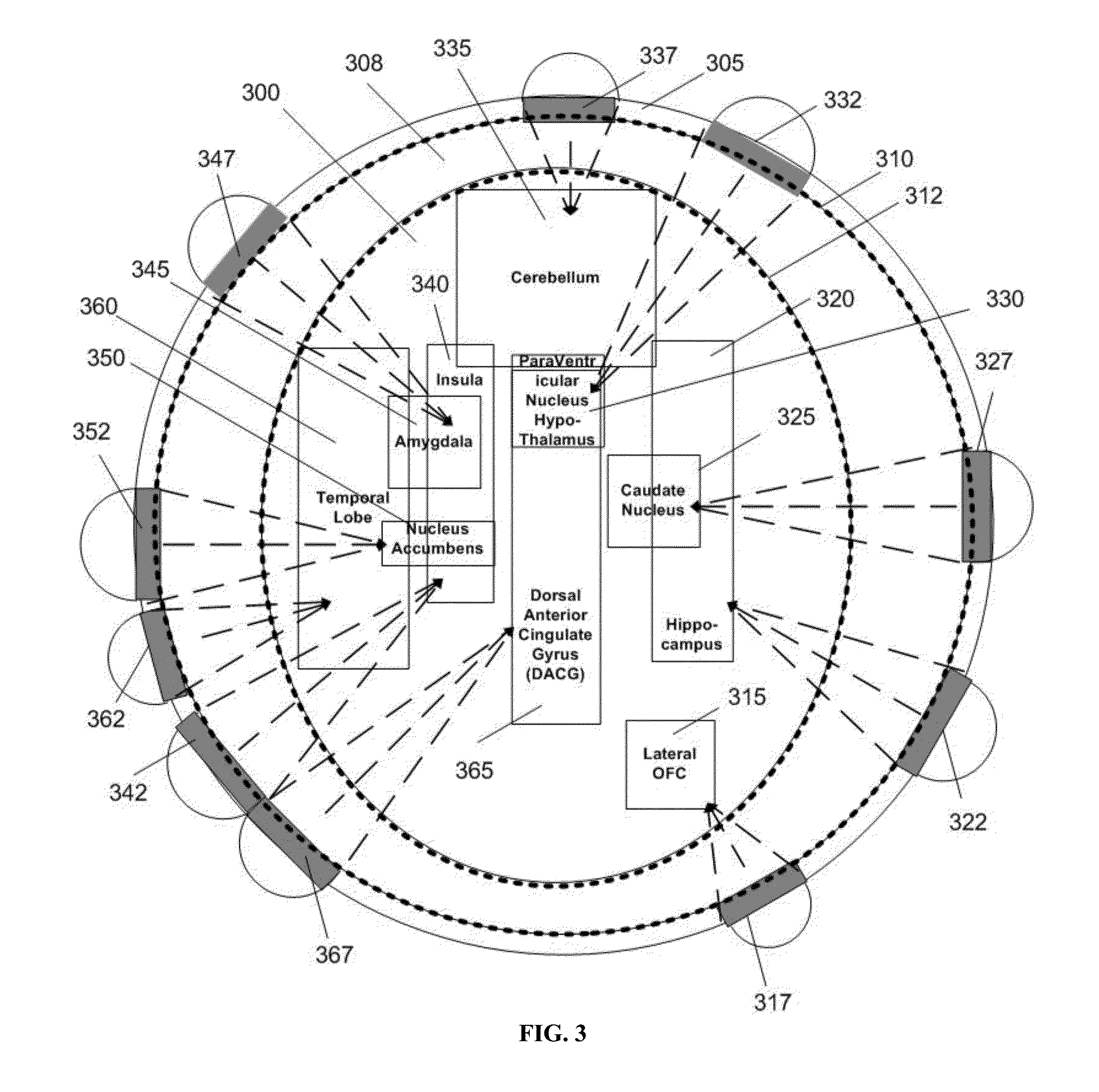 Stimulation method via deep-brain stimulation