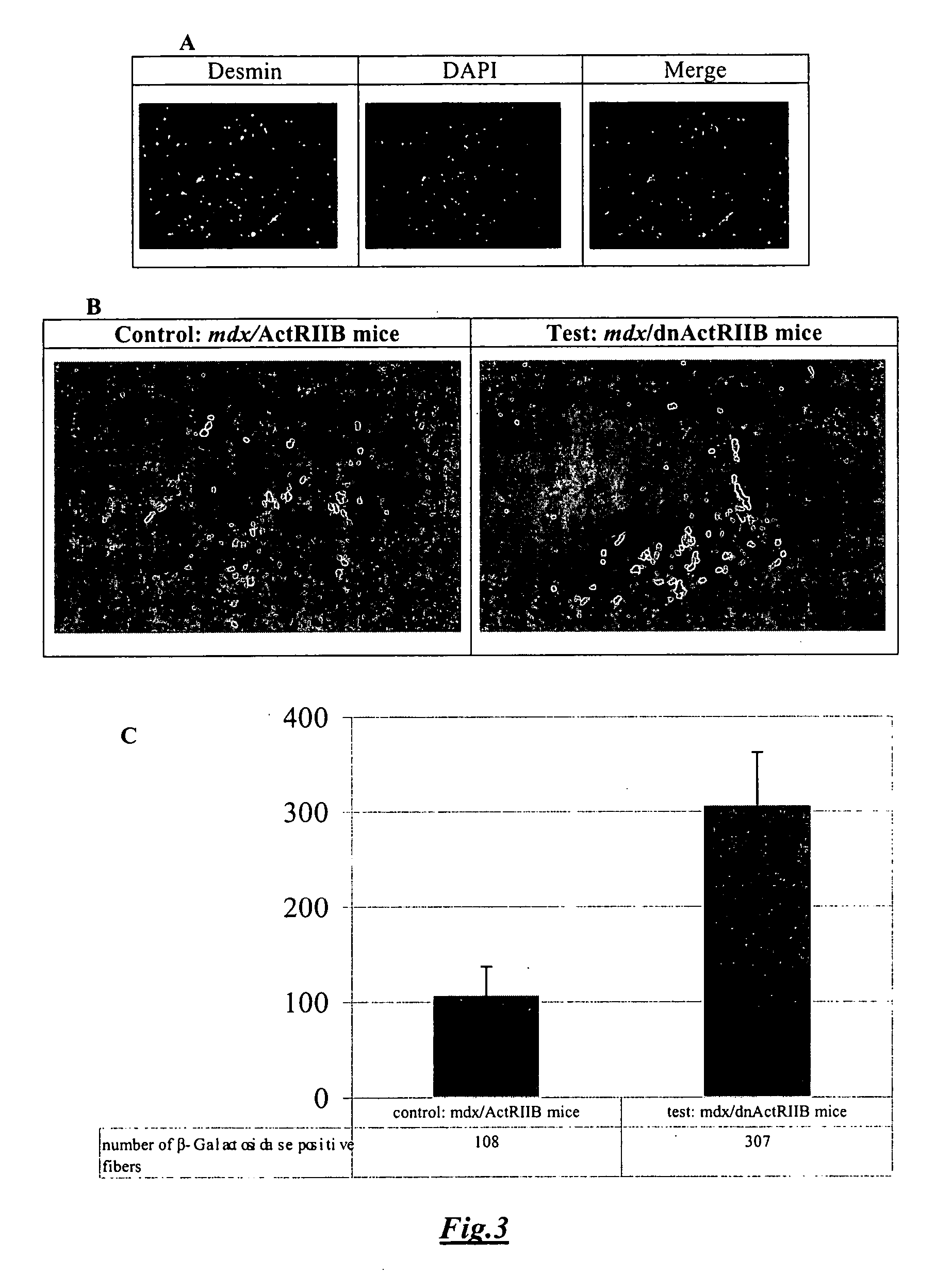 Modulation of myostatin and use thereof in cell transplantation-based treatment of muscle disease