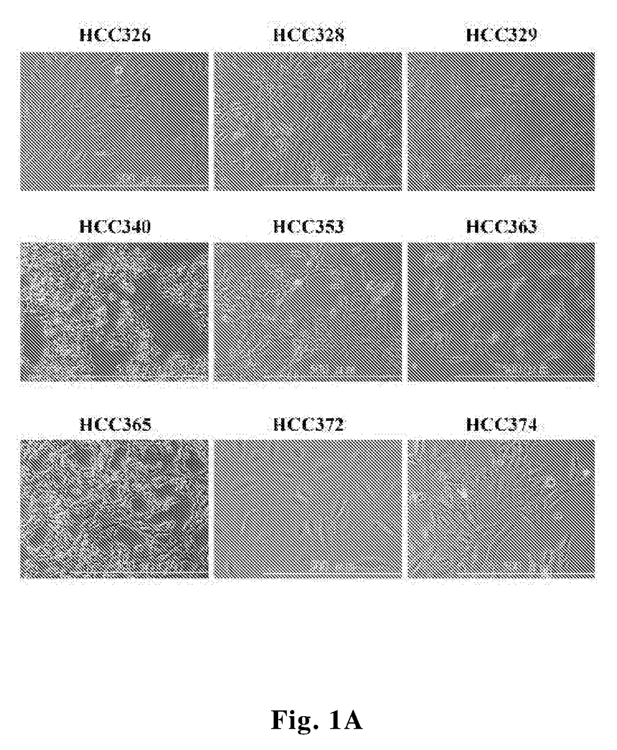 Methods and compositions for treating c-met associated cancers