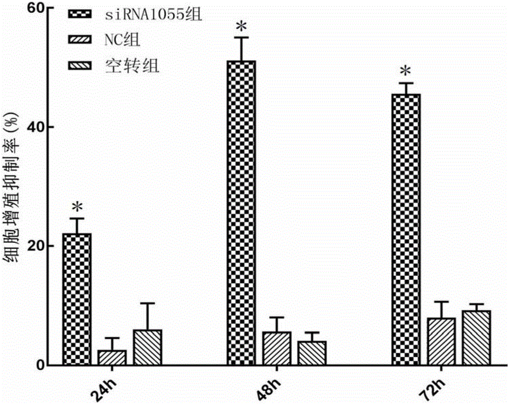 PVT1 siRNA-1055 for inhibiting blood tumor cell proliferation and application thereof