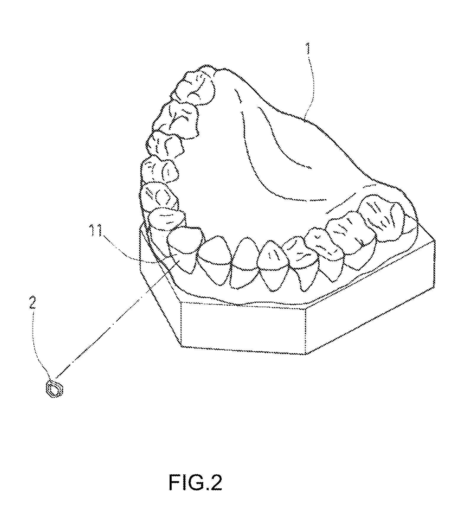 Method for positioning orthodontic braces