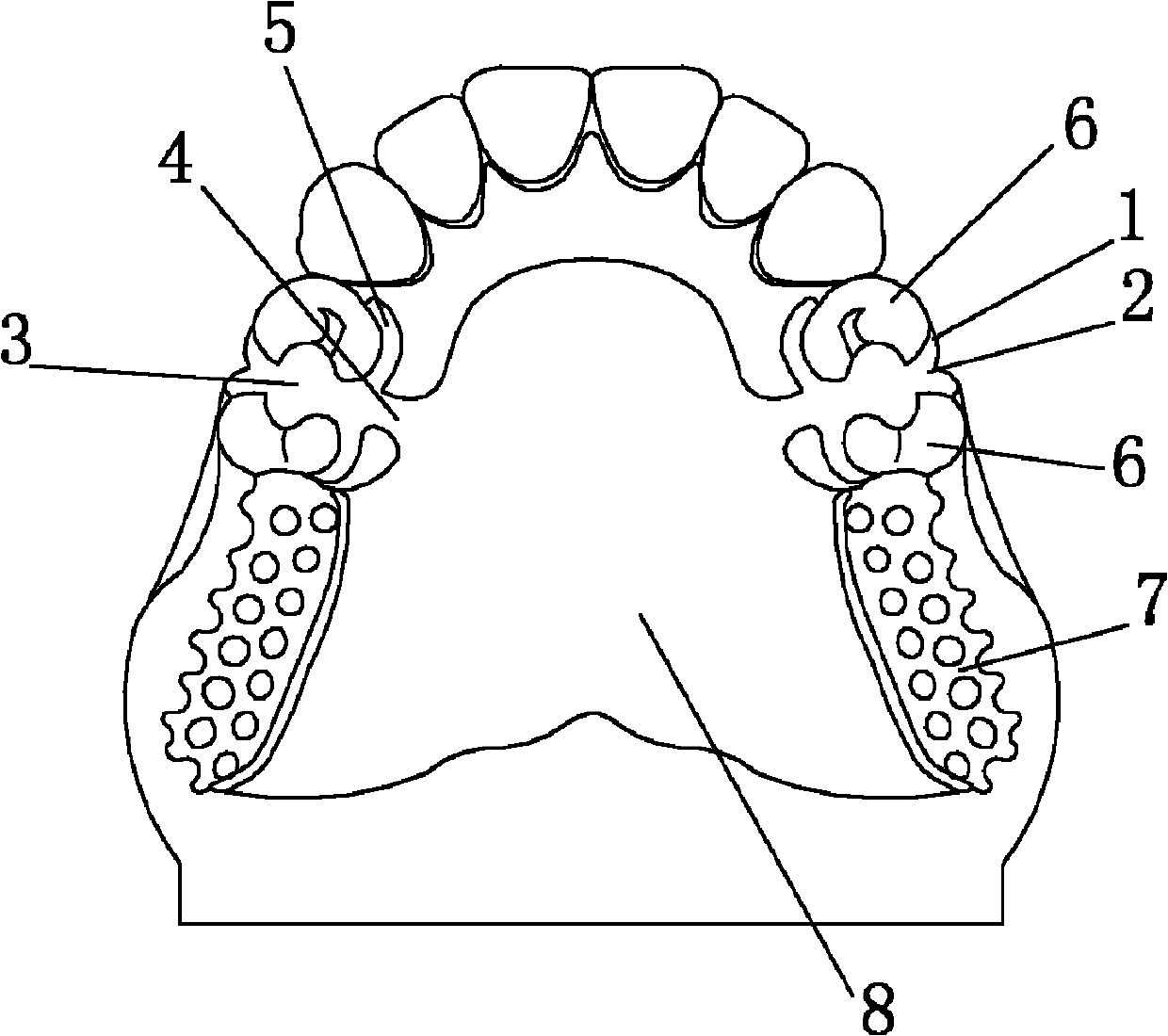 Combined short arm clasp for removable partial denture