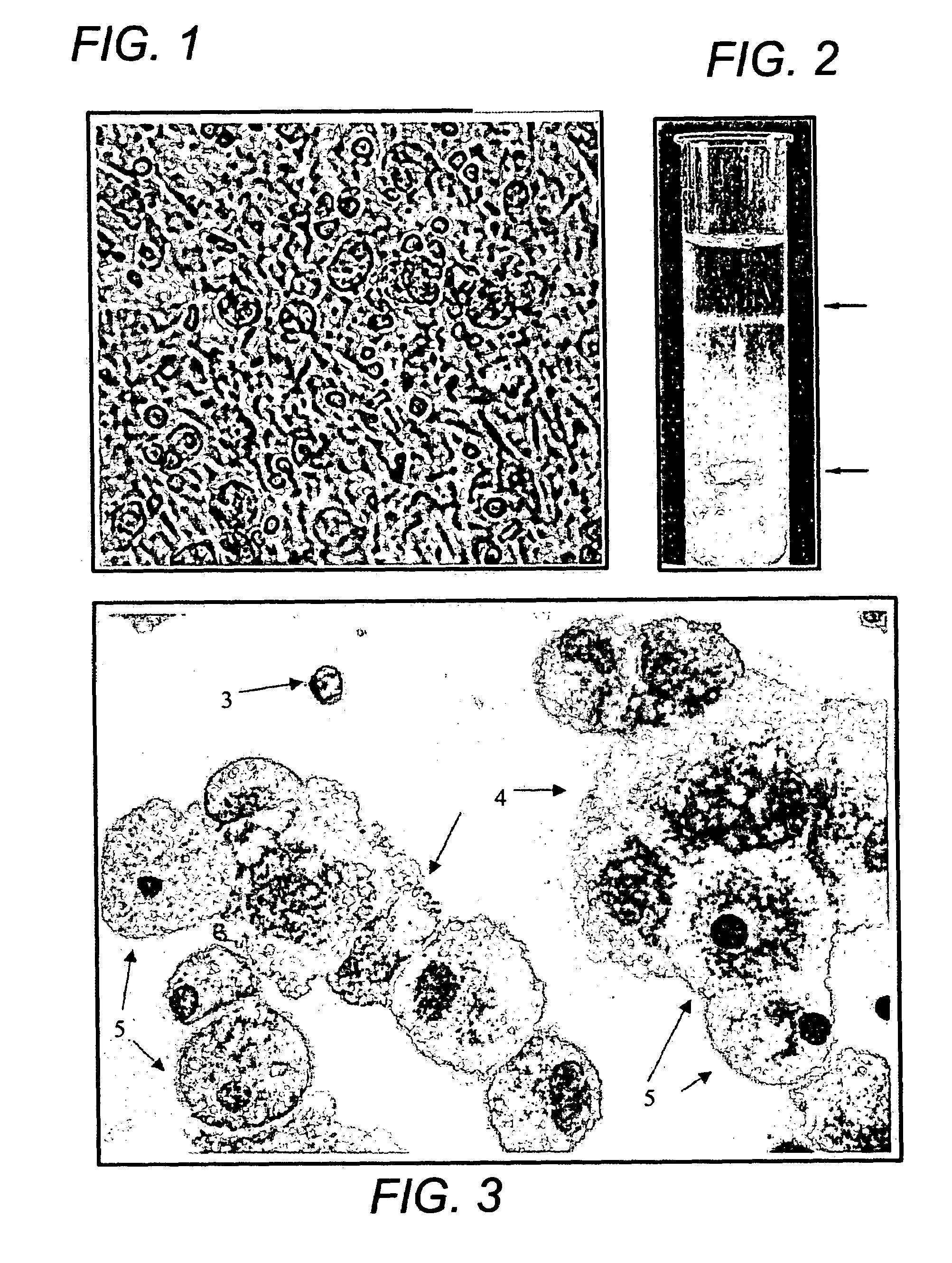 Method for purifying pluri-differentiated mesenchymal progenitor cells