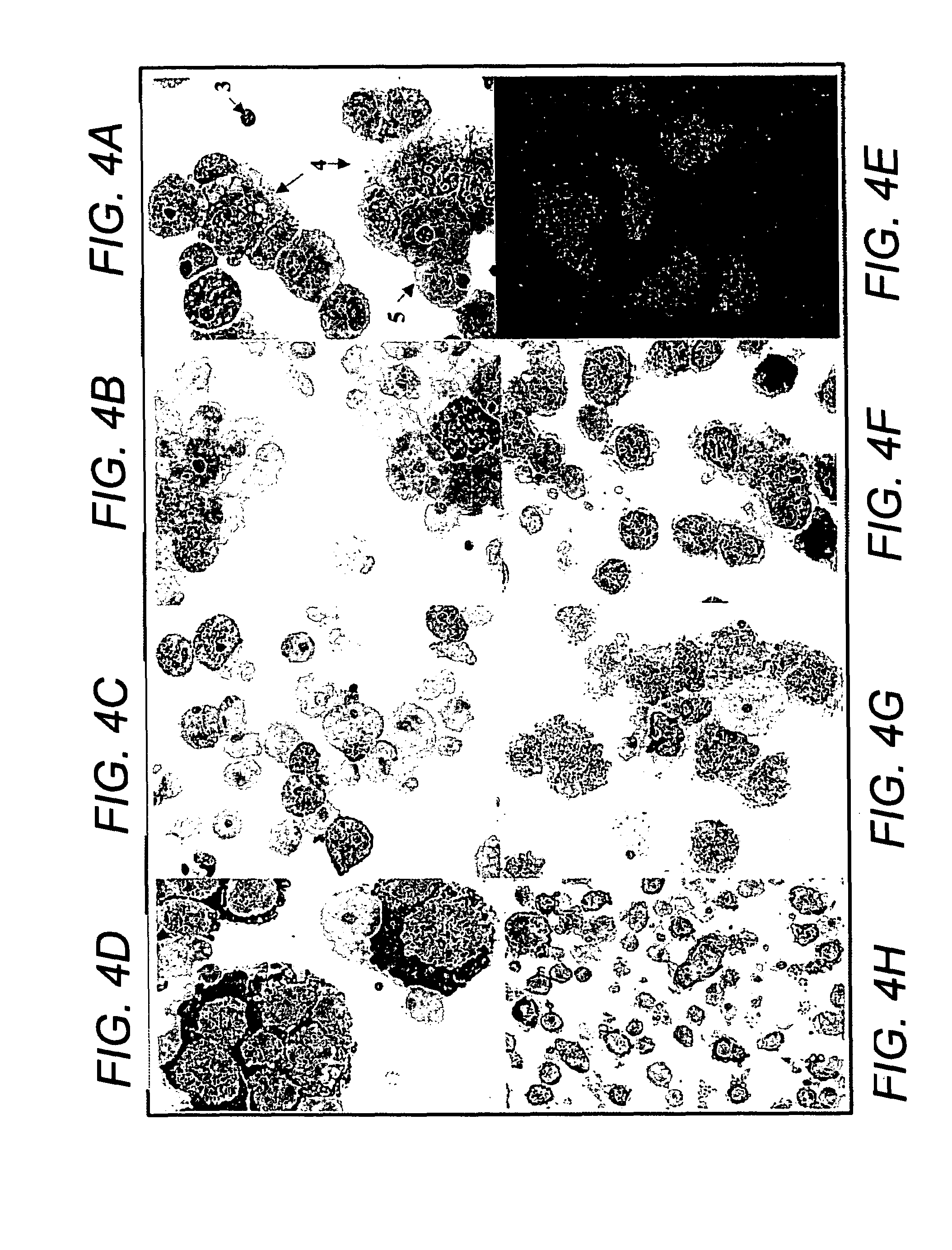 Method for purifying pluri-differentiated mesenchymal progenitor cells