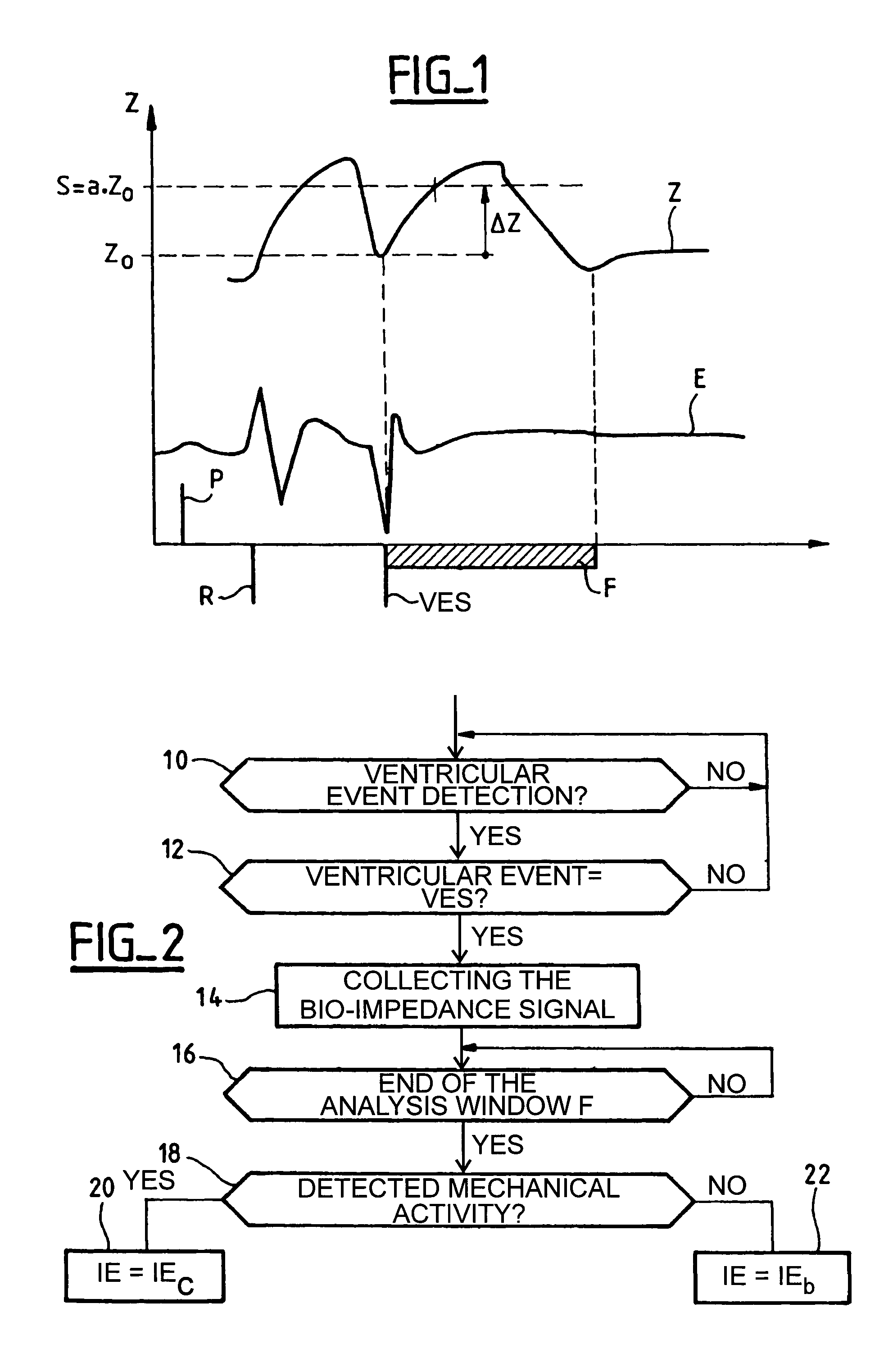 Discrimination of noxious and non noxious ventricular extrasystoles in an active implantable medical device such as a cardiac pacemaker, defibrillator, cardiovertor and/or multisite device