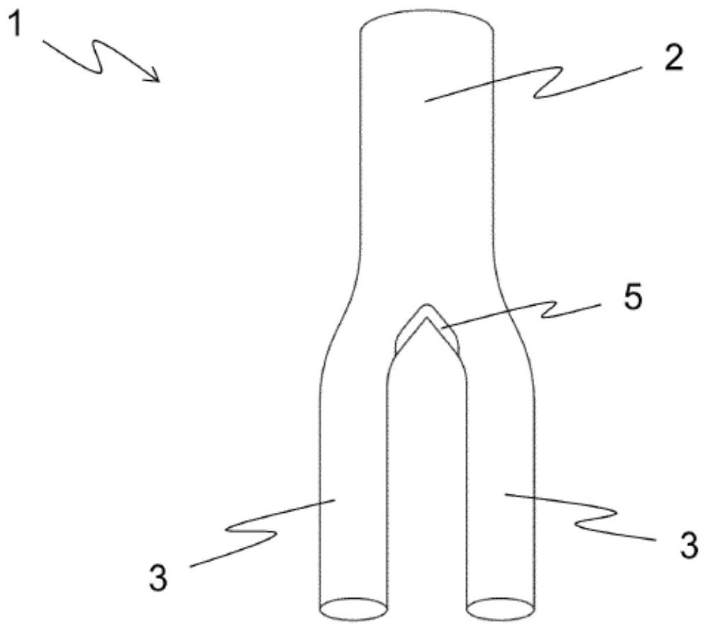 Braided structure, in particular stent, and method for braiding braided structure