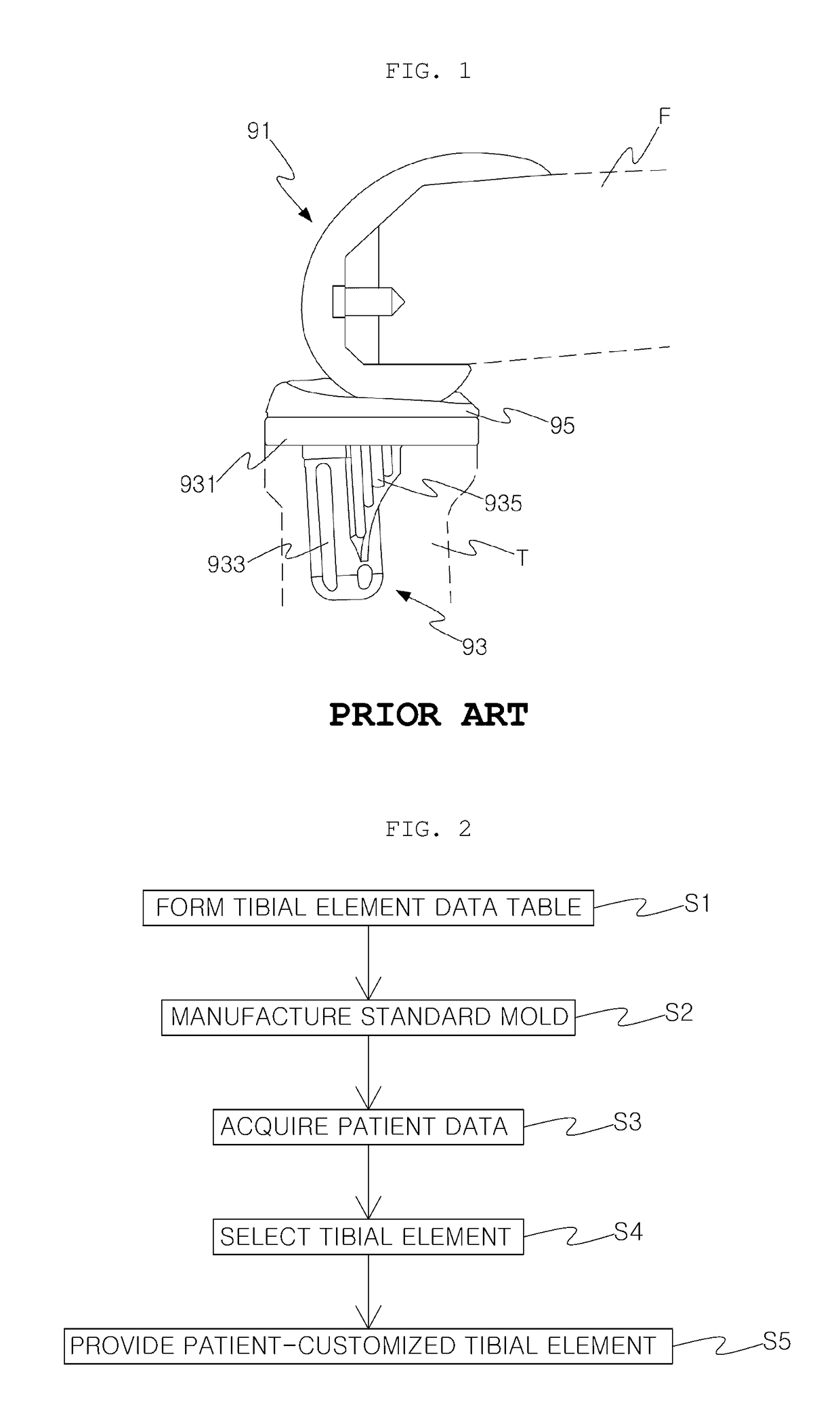 Method of manufacturing patient-customized tibial element
