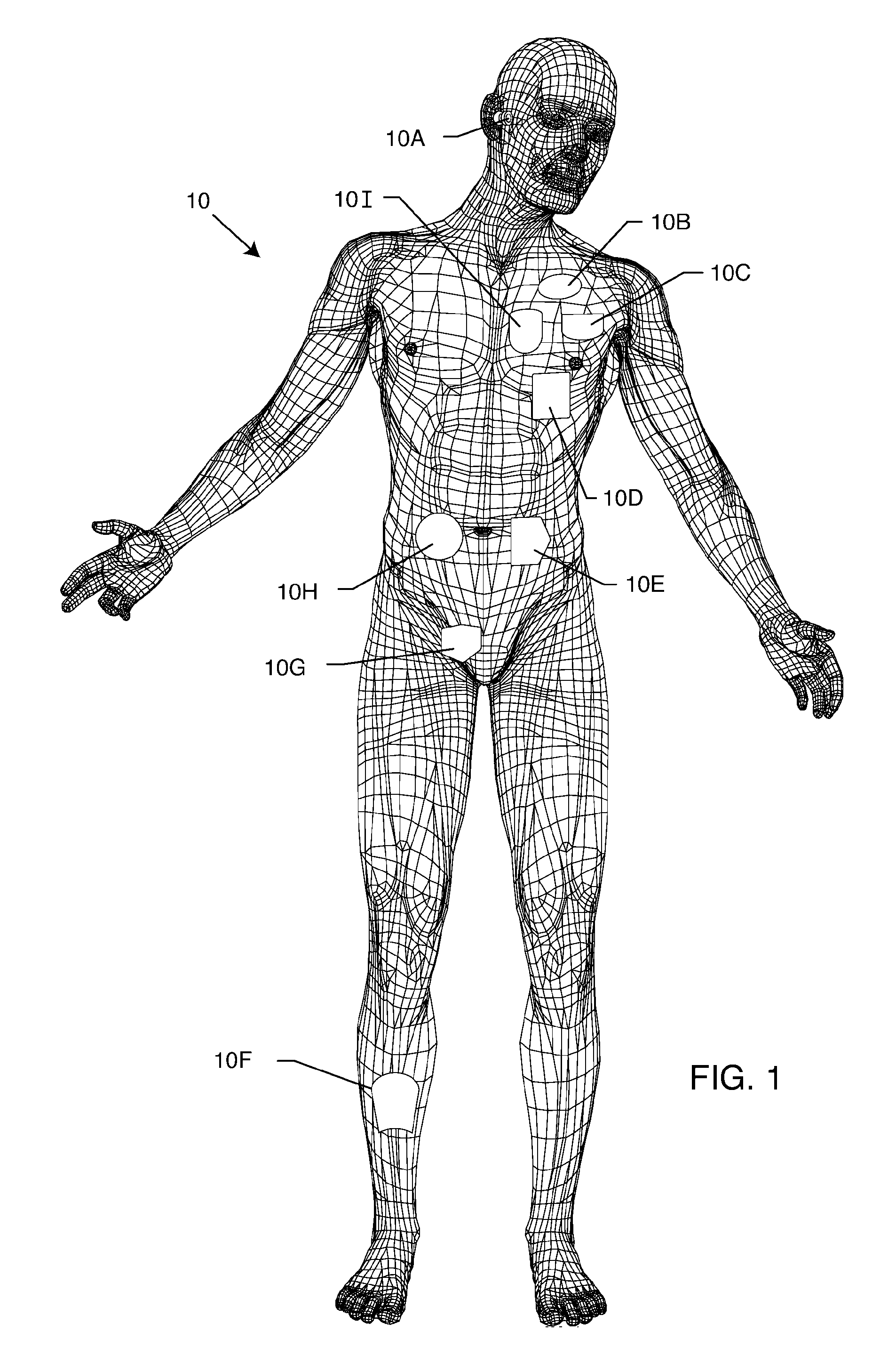 Device to protect an active implantable medical device feedthrough capacitor from stray laser weld strikes, and related manufacturing process