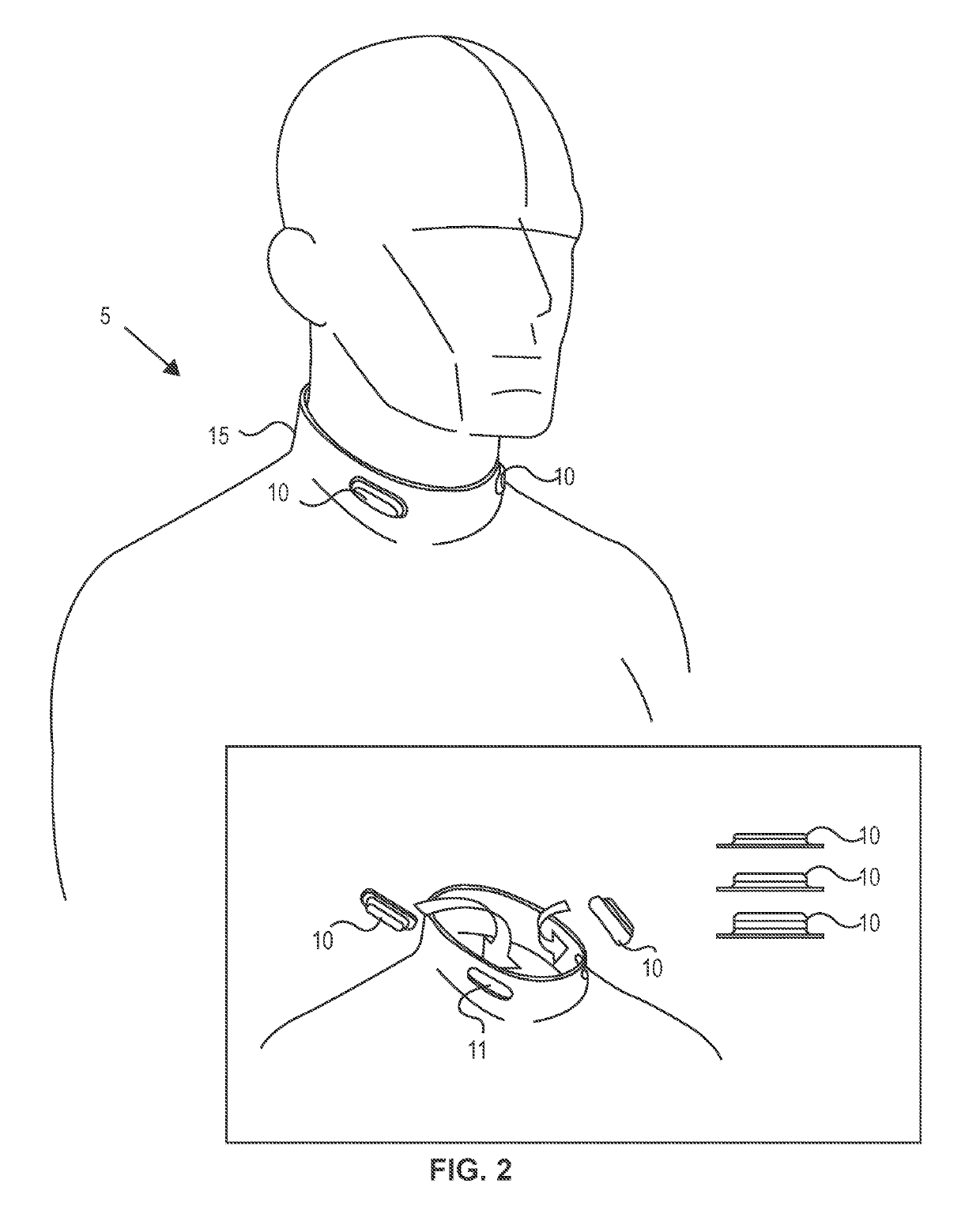 Methods and devices to reduce damaging effects of concussive or blast forces on a subject