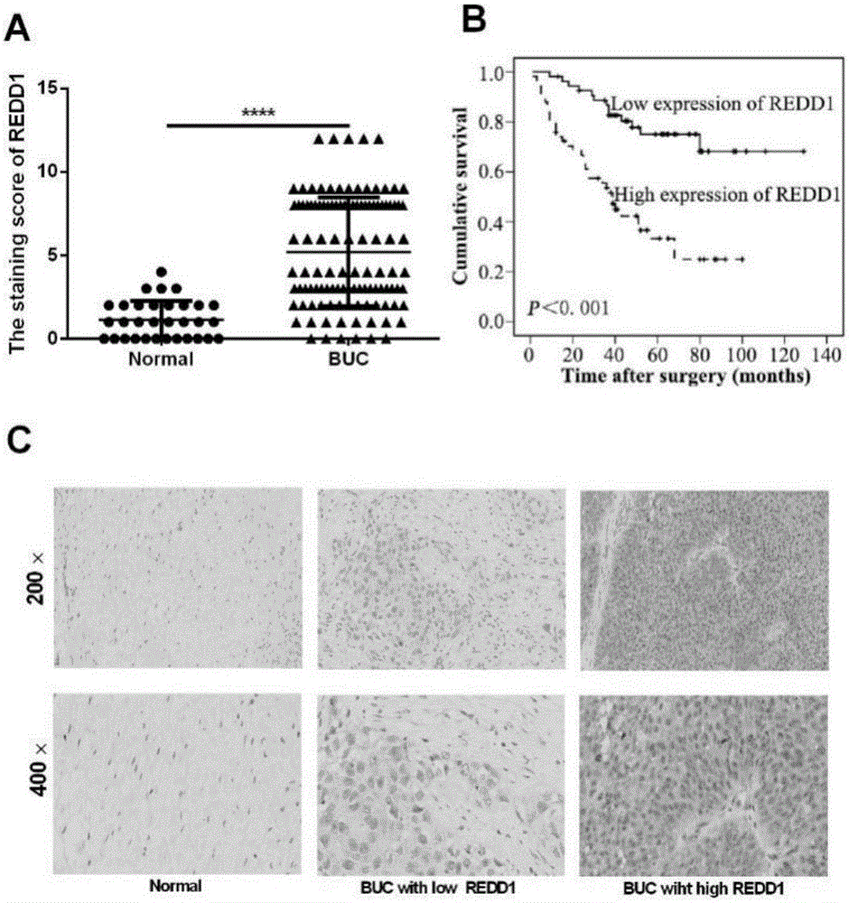 Application of miR-22 in preparation of bladder cancer chemosensitization treatment drugs as target site