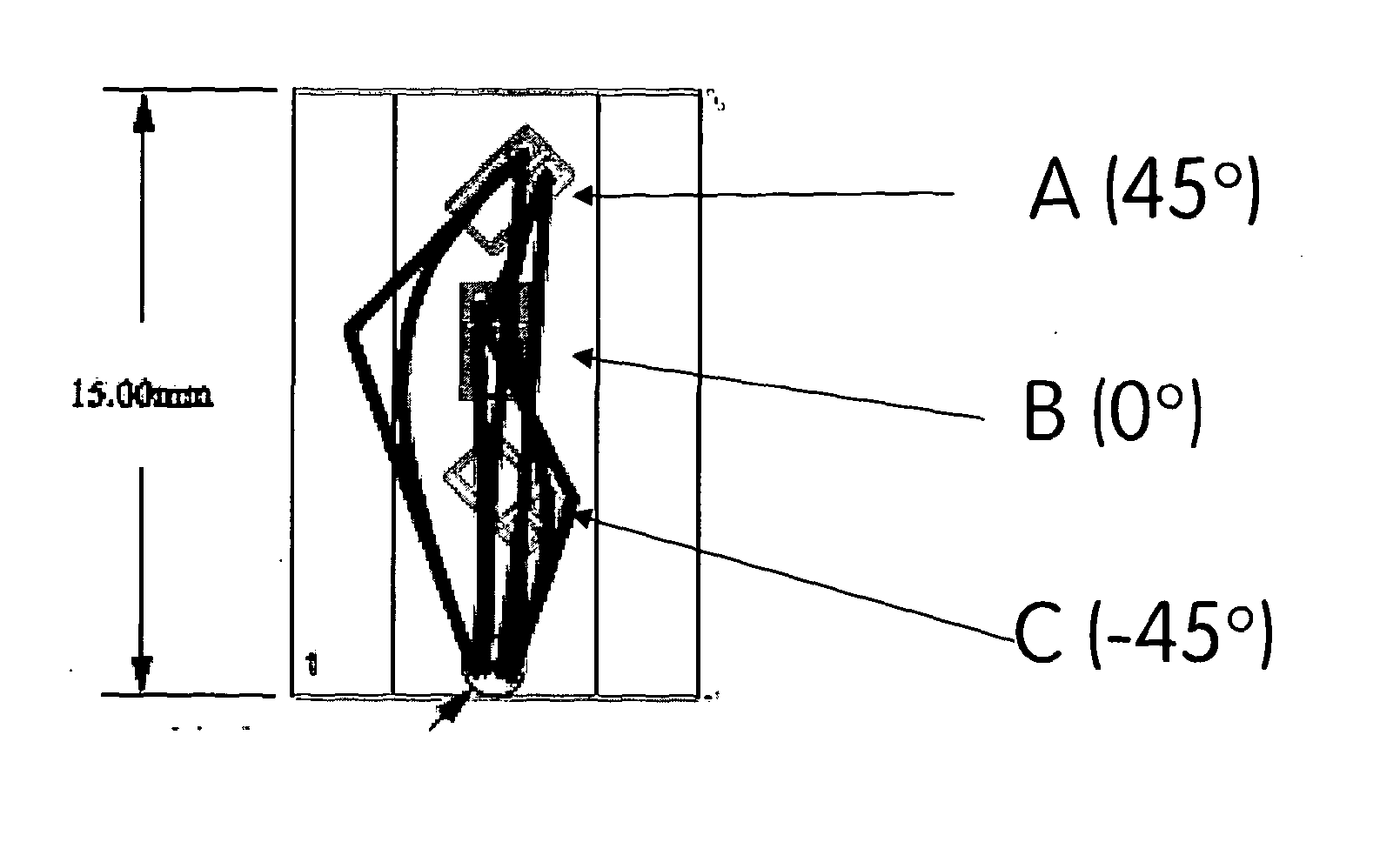 Telemetric orthopaedic implant