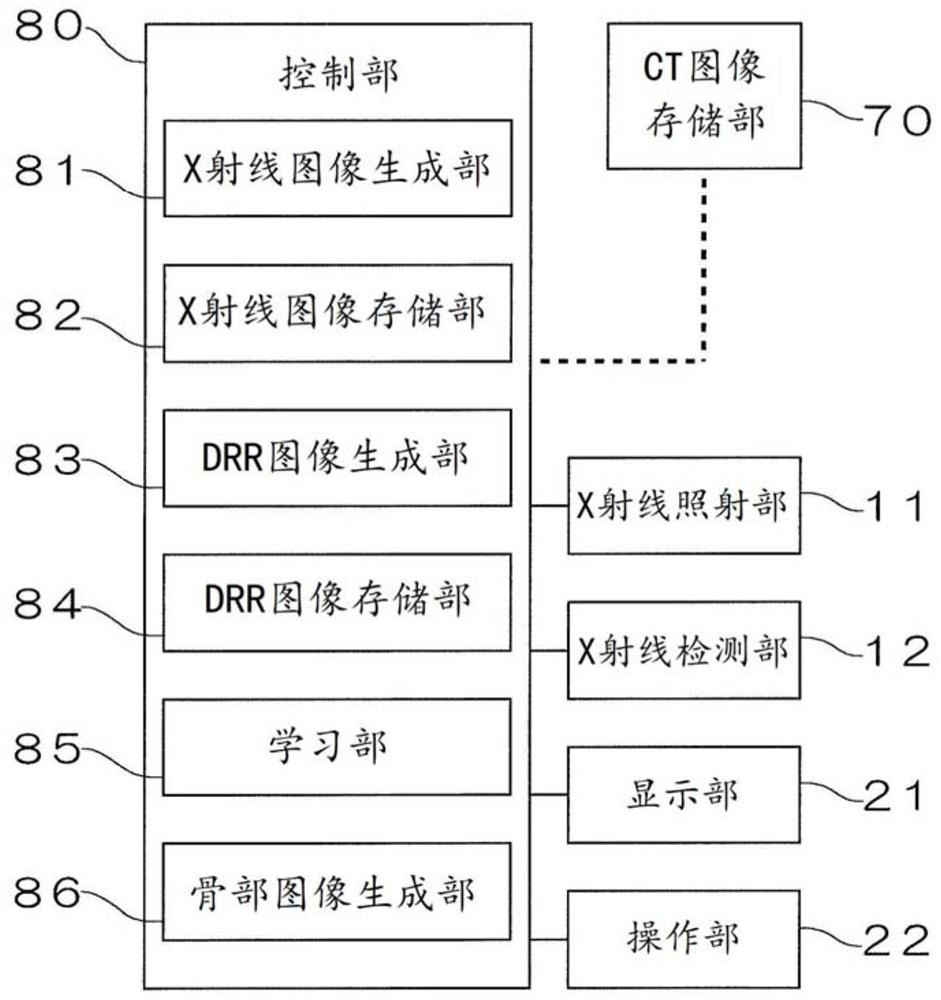 Image analysis method, segmentation method, bone density measurement method, learning model creation method, and image creation device