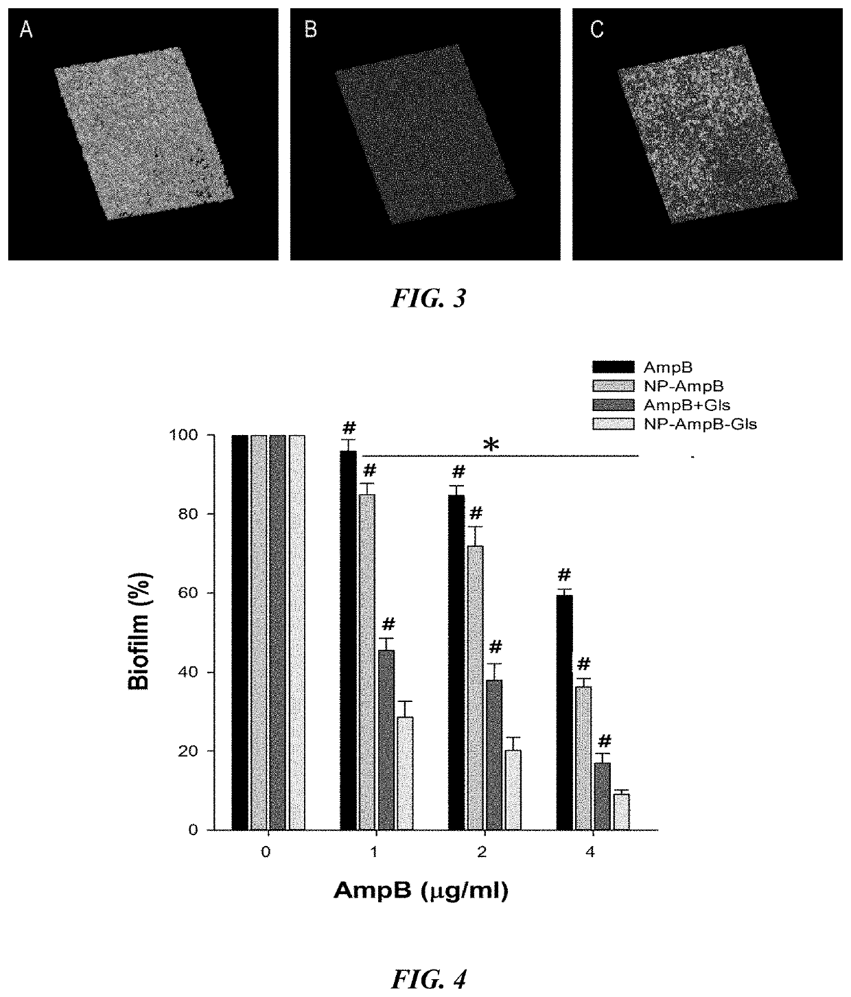 Amphotericin b and beta-1,3-glucanase loaded bi-functional nano-system with both targets, preparation method and application thereof