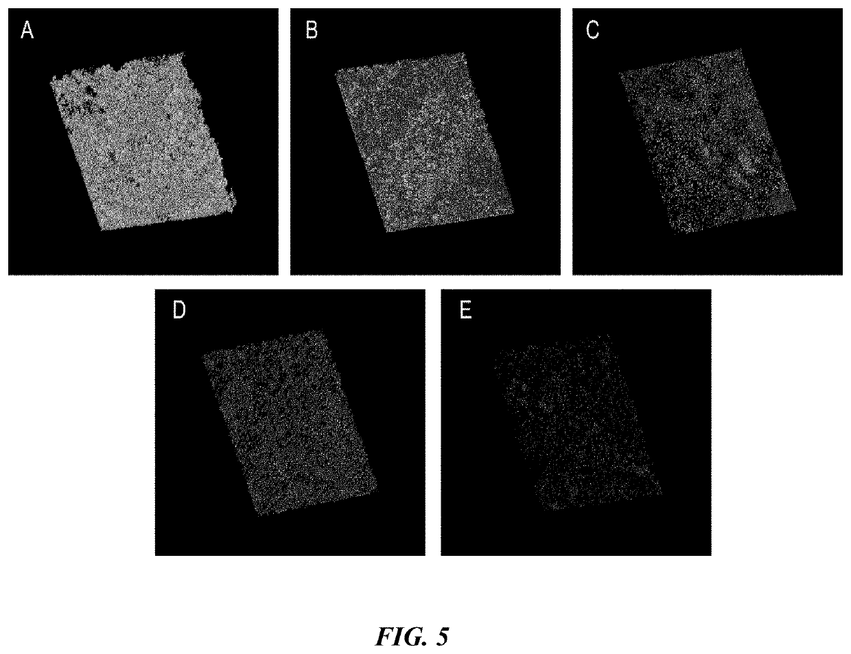 Amphotericin b and beta-1,3-glucanase loaded bi-functional nano-system with both targets, preparation method and application thereof