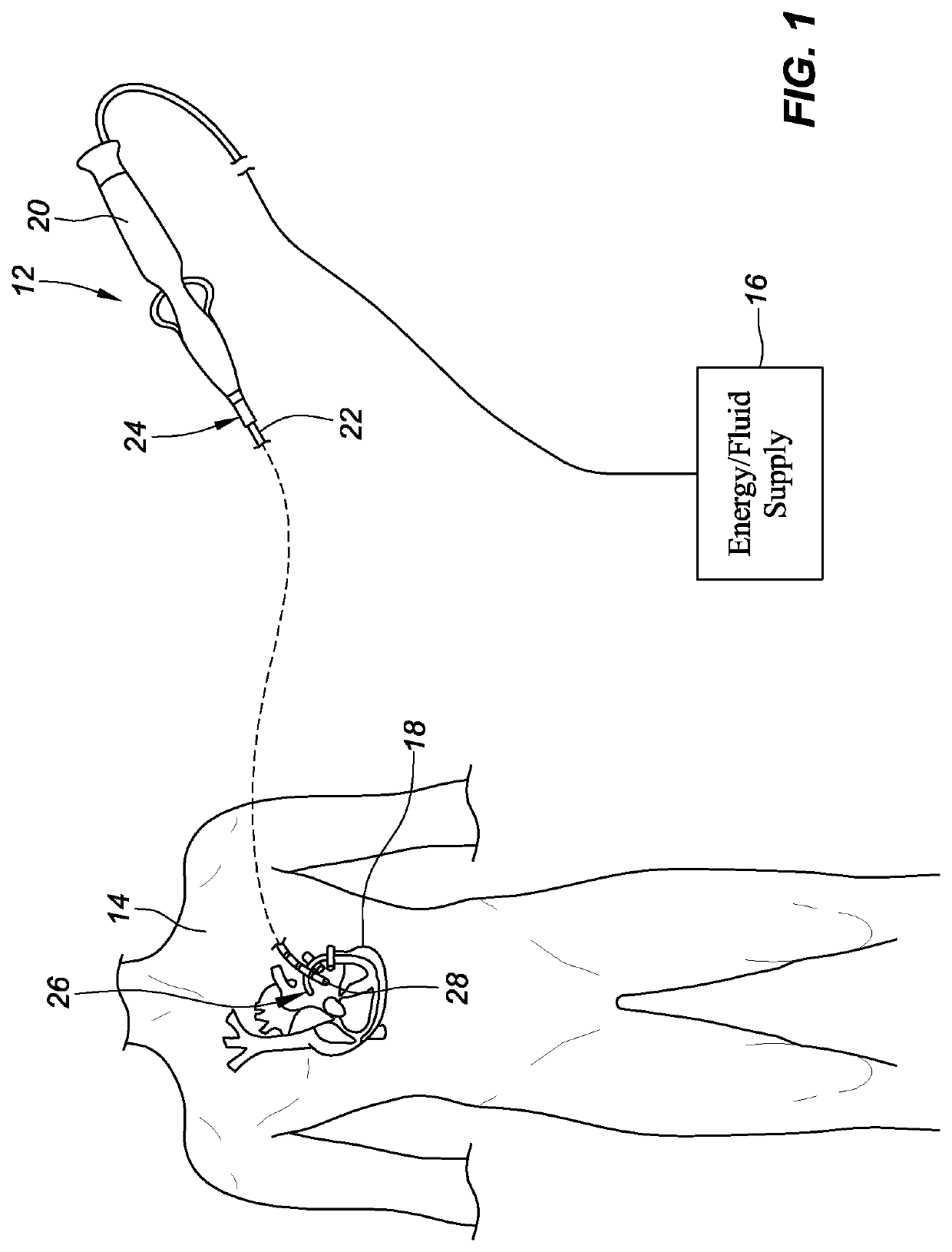 Pulmonary antrum radial-linear ablation devices