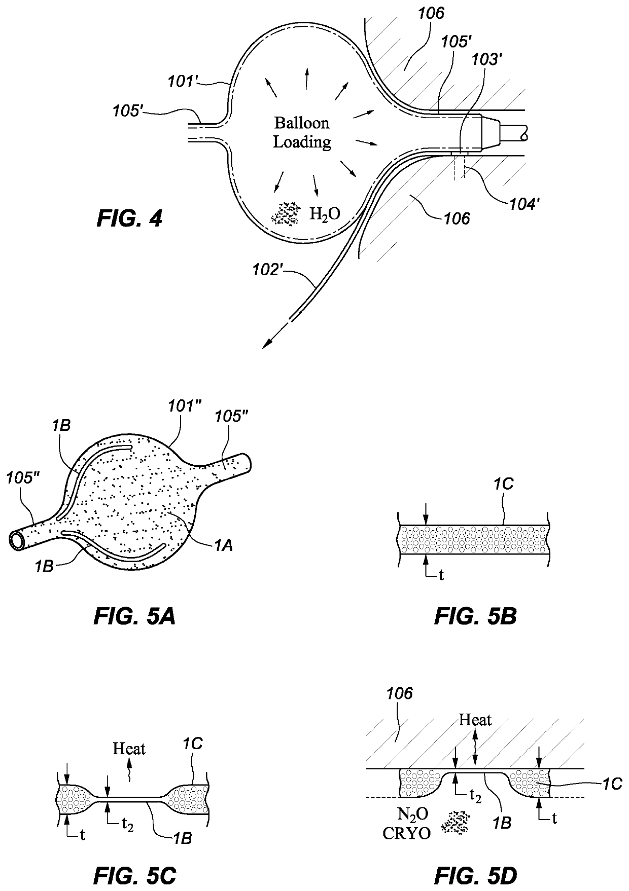 Pulmonary antrum radial-linear ablation devices