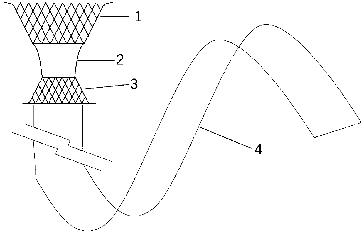 Endoscopic duodenum-jejunum bypass weight-reducing bracket and using method thereof