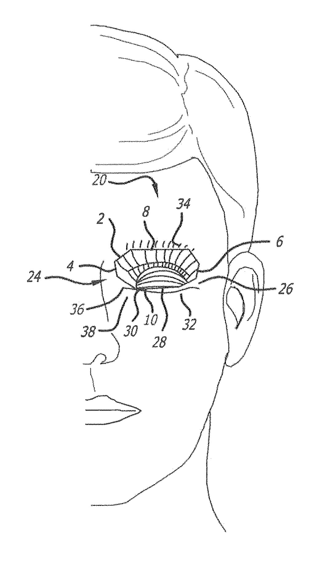 Tarsus eyelid patch